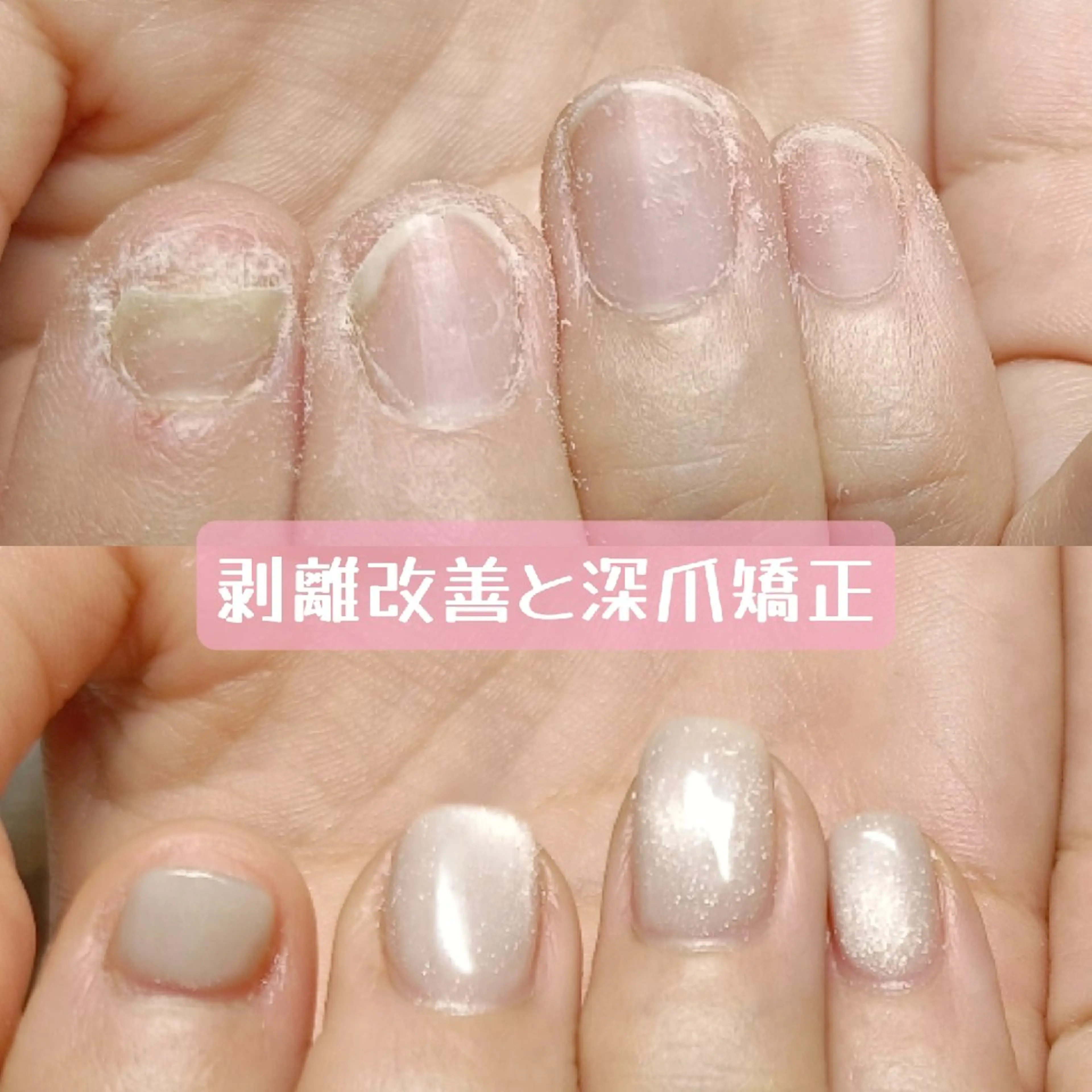 ネイル ハンドネイル ハンドケア 深爪矯正/爪育成ケア manie nailのネイルデザイン