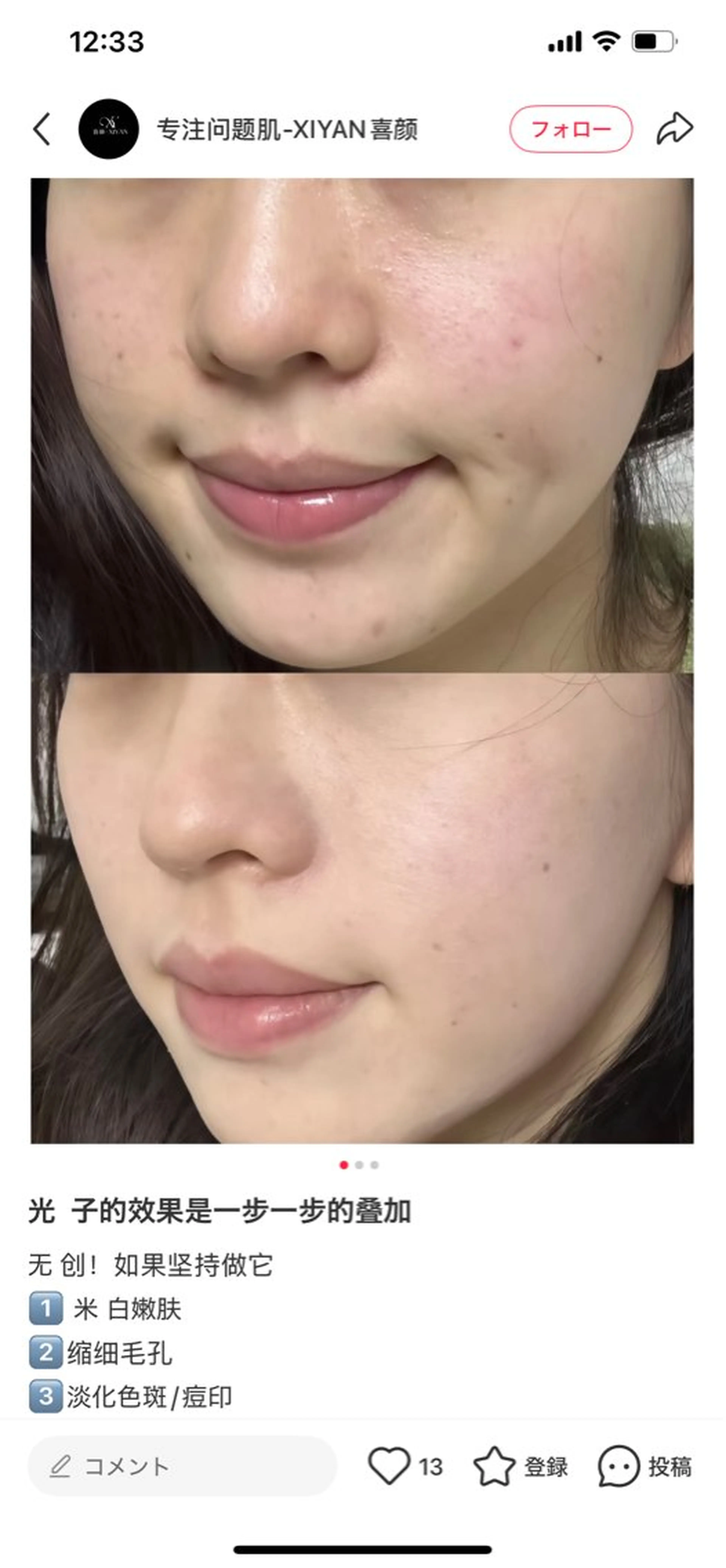 エステ 韓国式肌管理＠毛穴洗浄 THE ONE 栄店所属・THEONE 山本のエステ・リラクイメージ