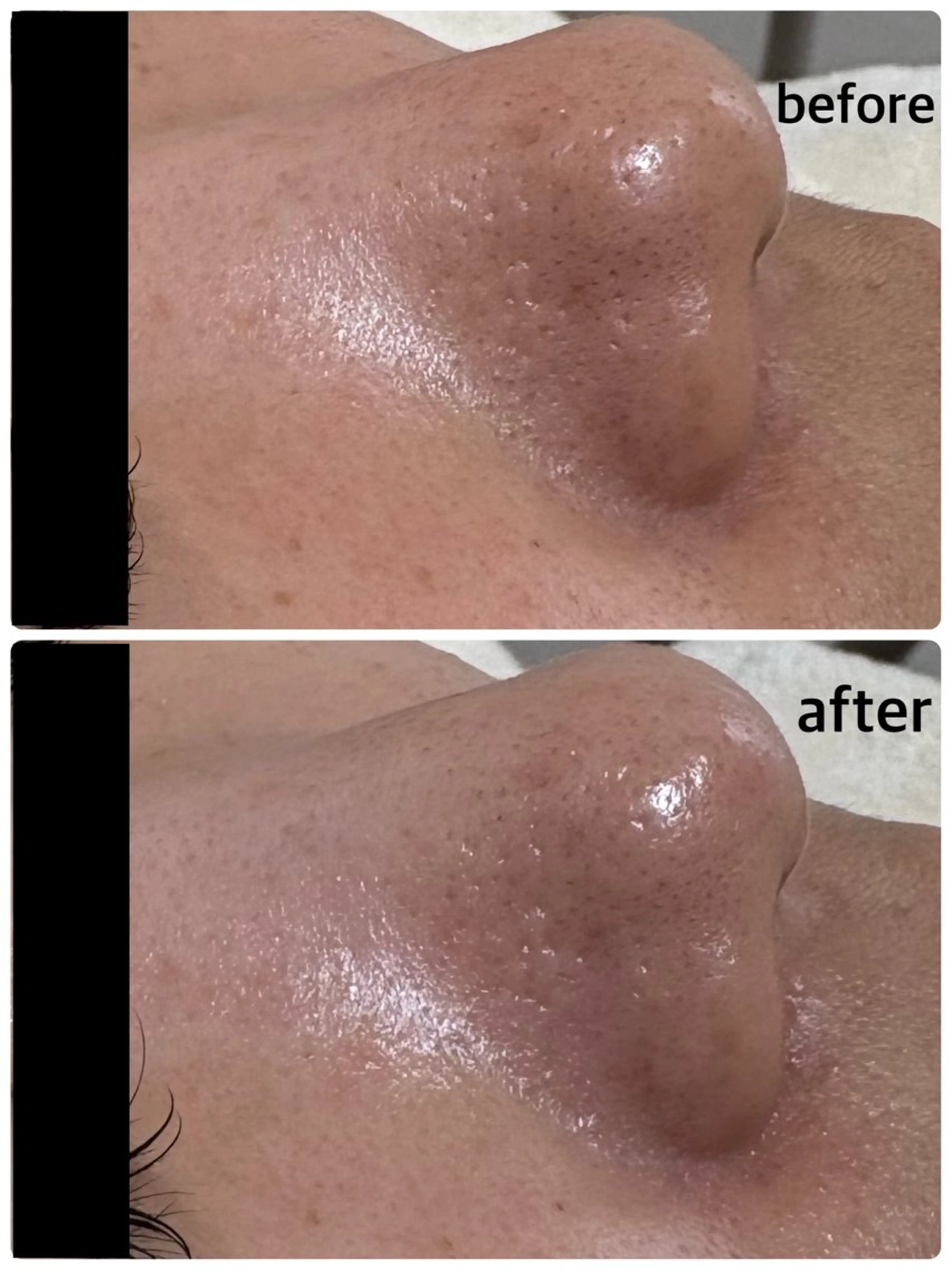 エステ 【たるみケア/毛穴引 き締め/よもぎ蒸し】のエステ・リラクイメージ