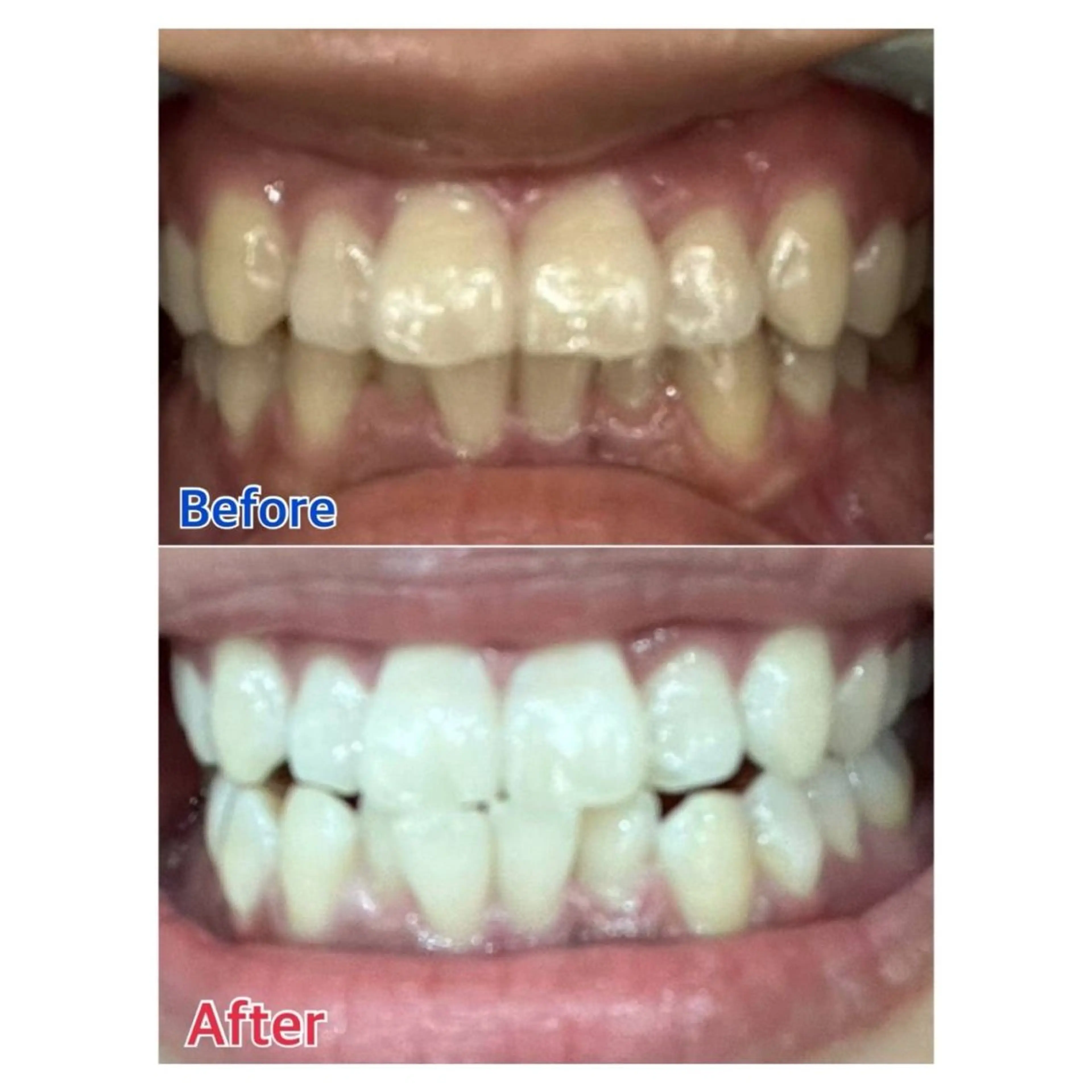 MBEAUTYSALON 千葉店・京成大久保所属・Melty 輝のその他イメージ