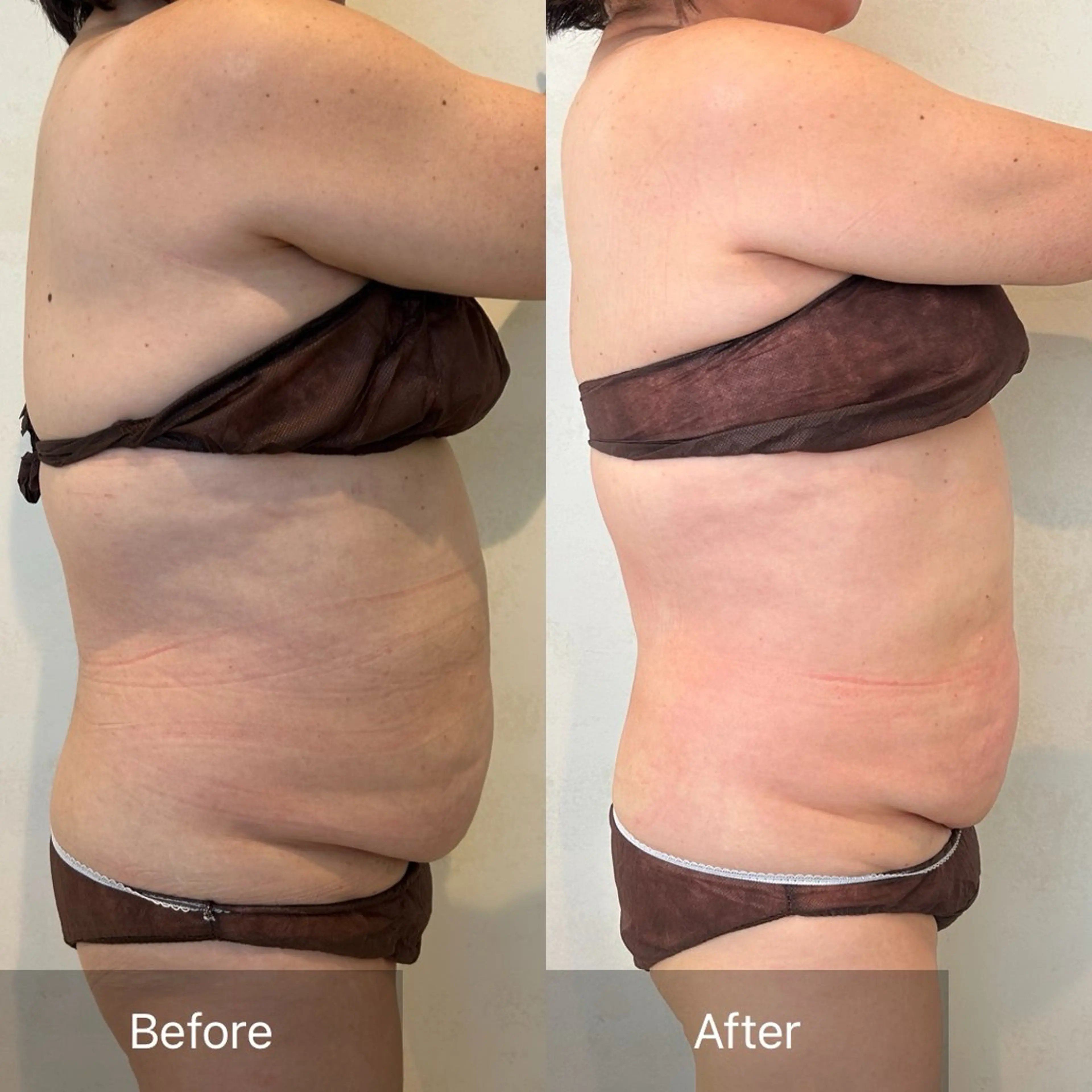 初回最強痩身レモン🍋10ccの写真