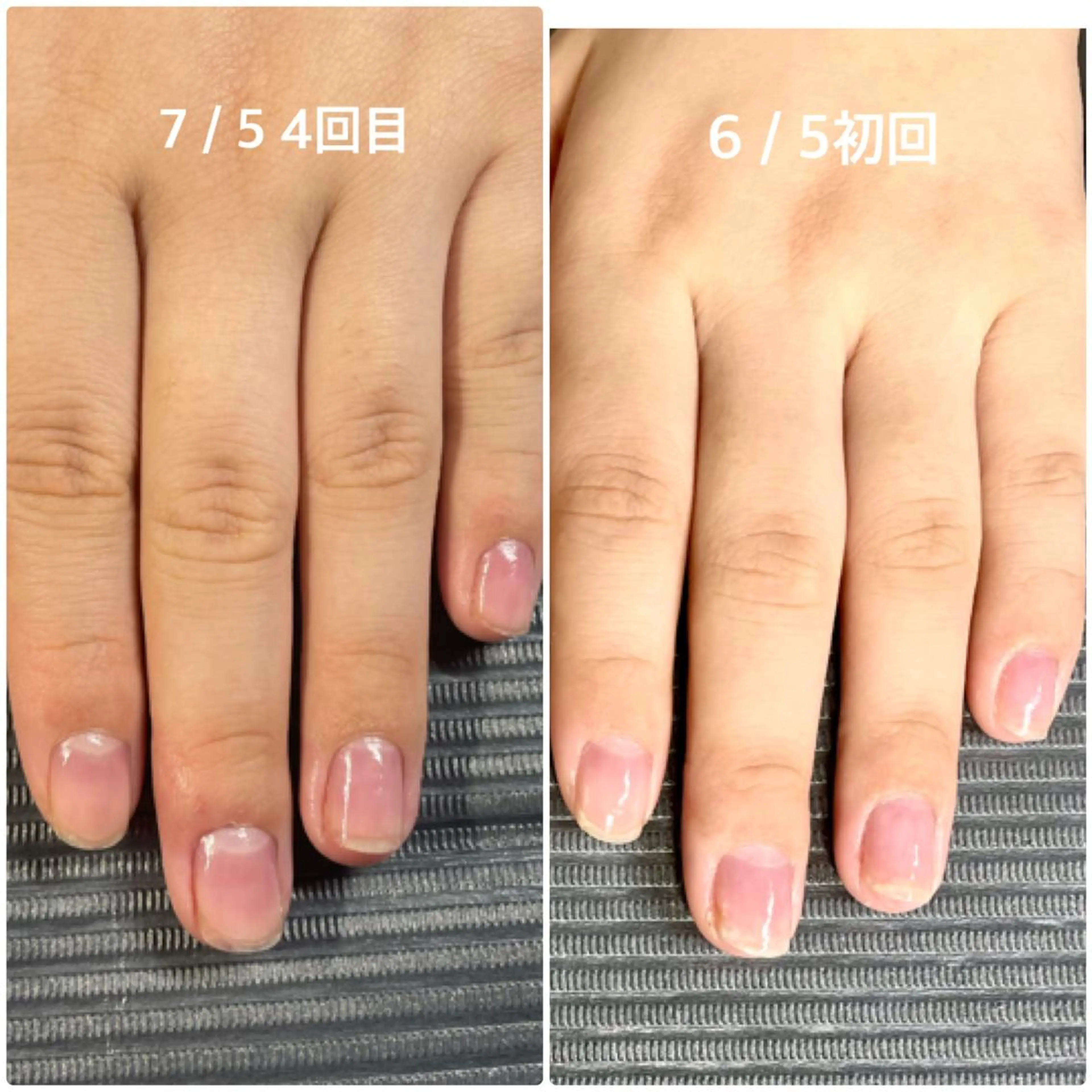 ネイル 奥園 良恵のネイルデザイン