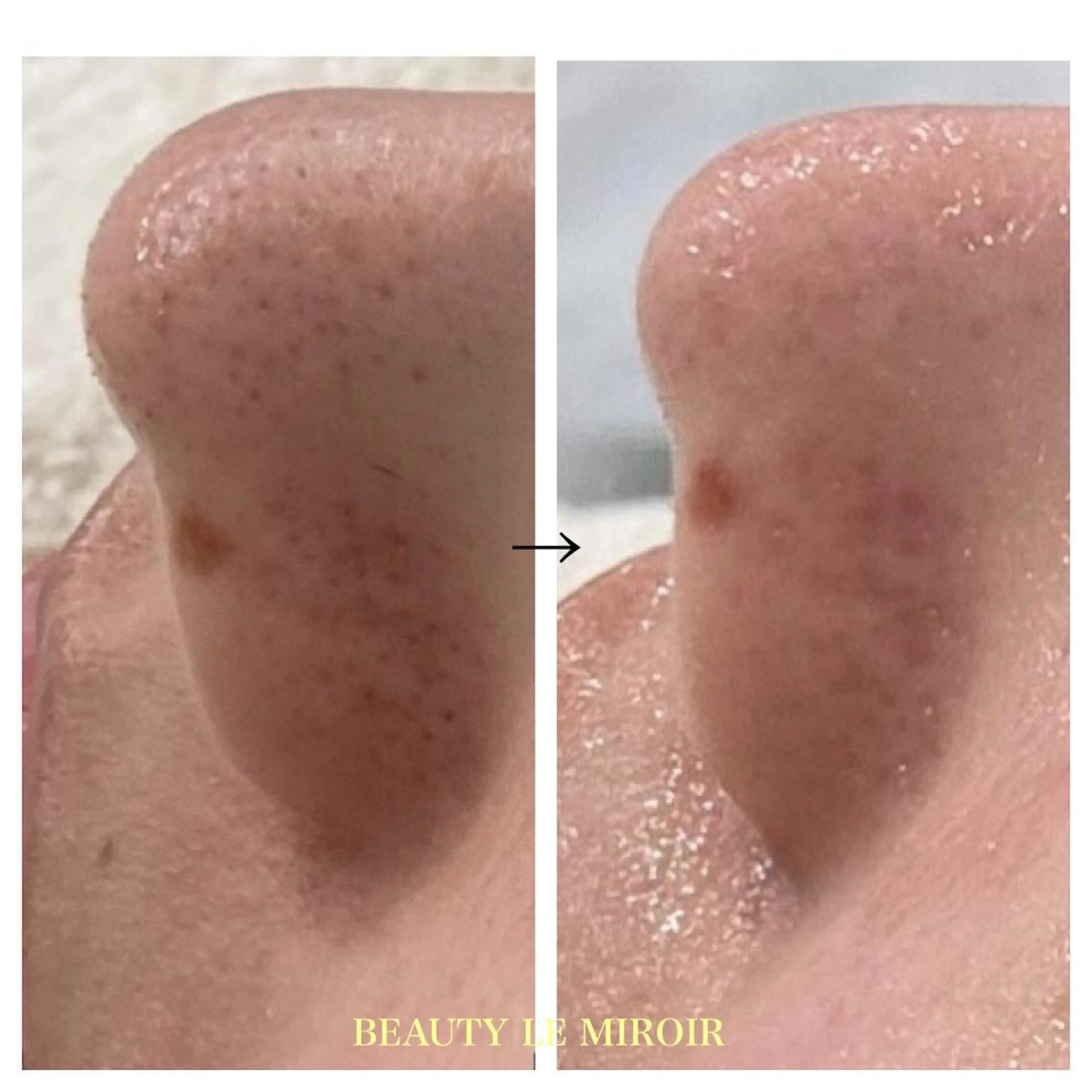 ビューティー ミロワールのエステ・リラクイメージ