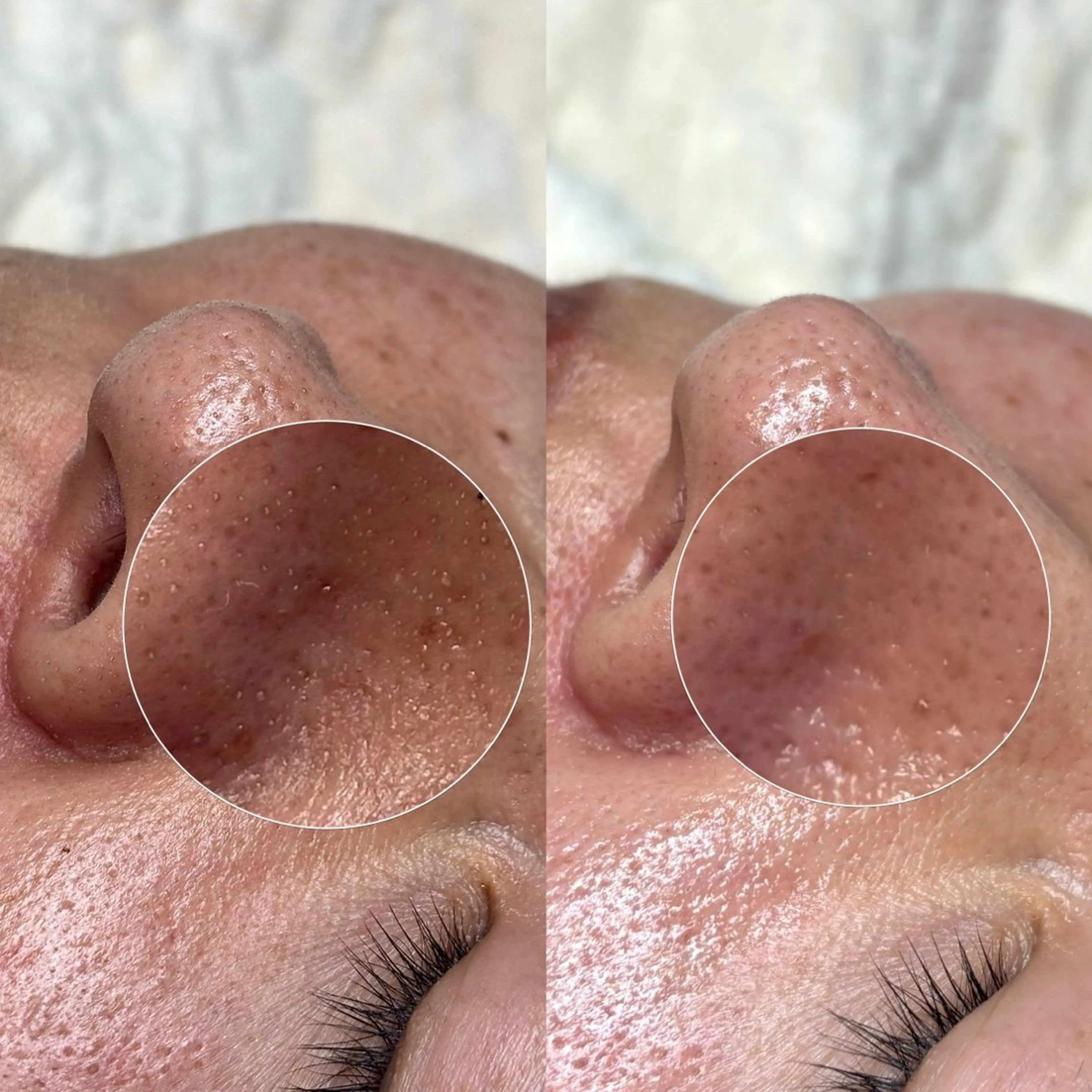 メンズ エステ Suu.今池/千種 メンズ眉毛の眉毛・アイブロウイメージ