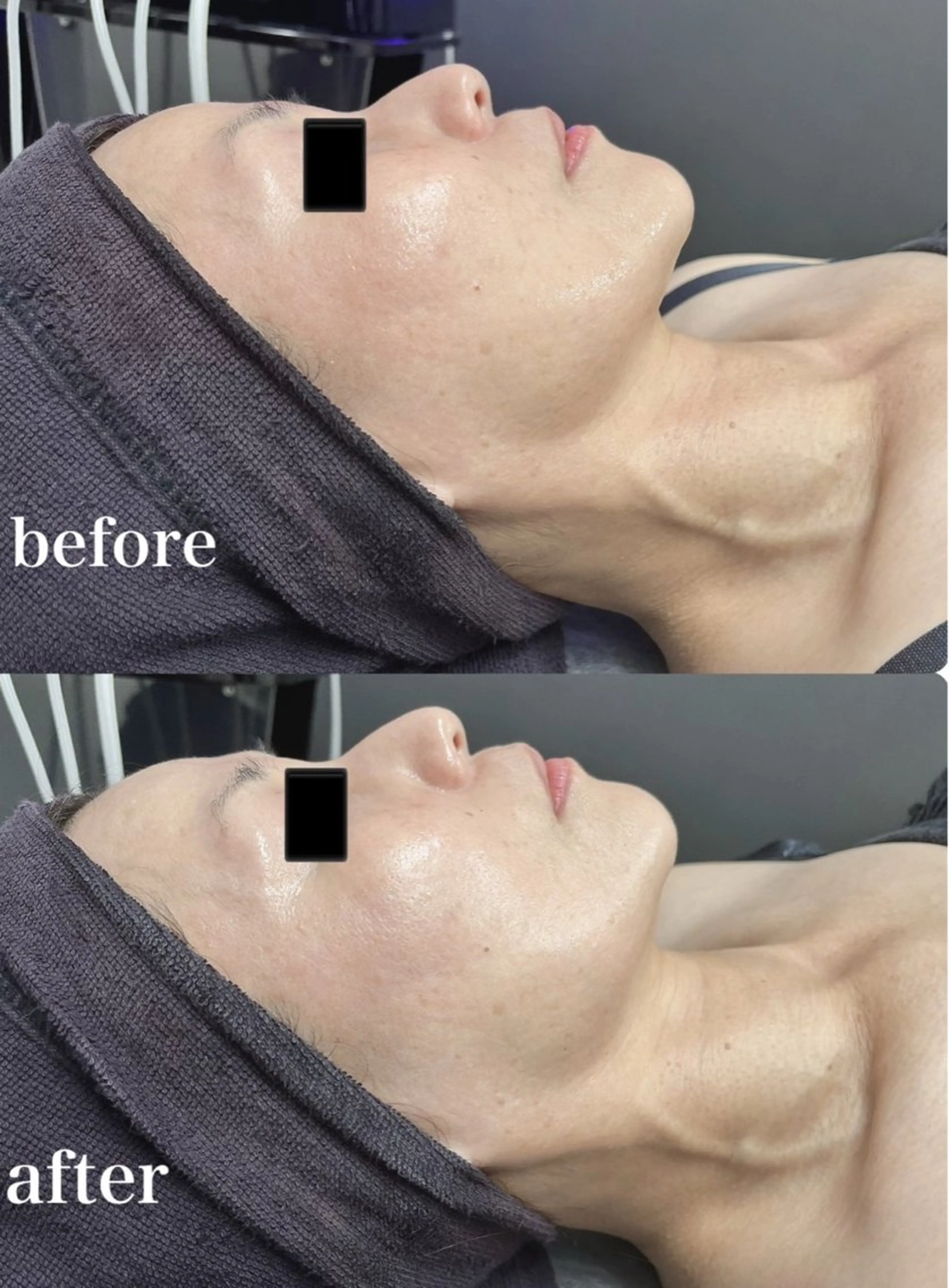 エステ Genesis Plus大津京店のエステ・リラクイメージ