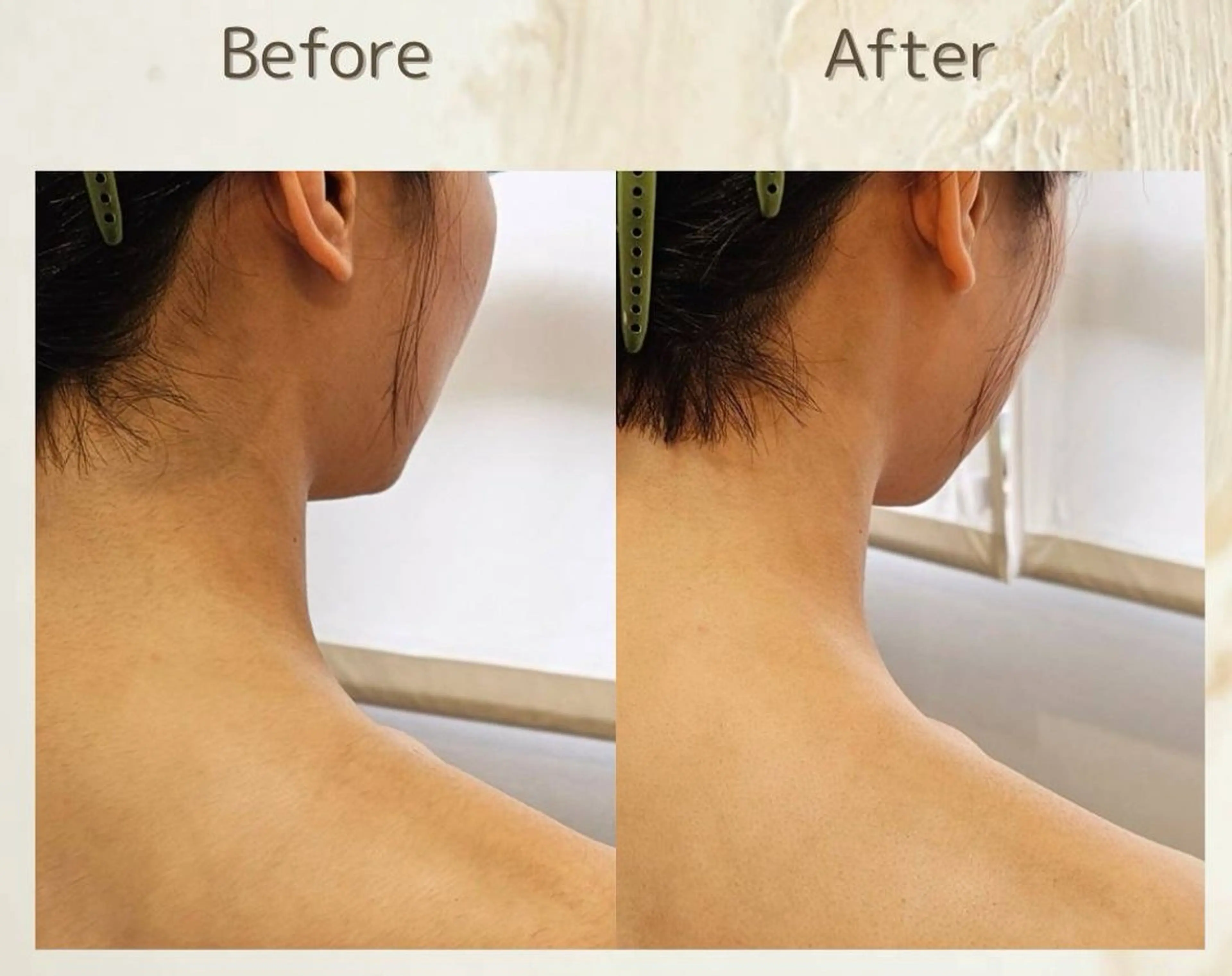 その他 シェービングサロン ＆W/アンダブルのエステ・リラクイメージ