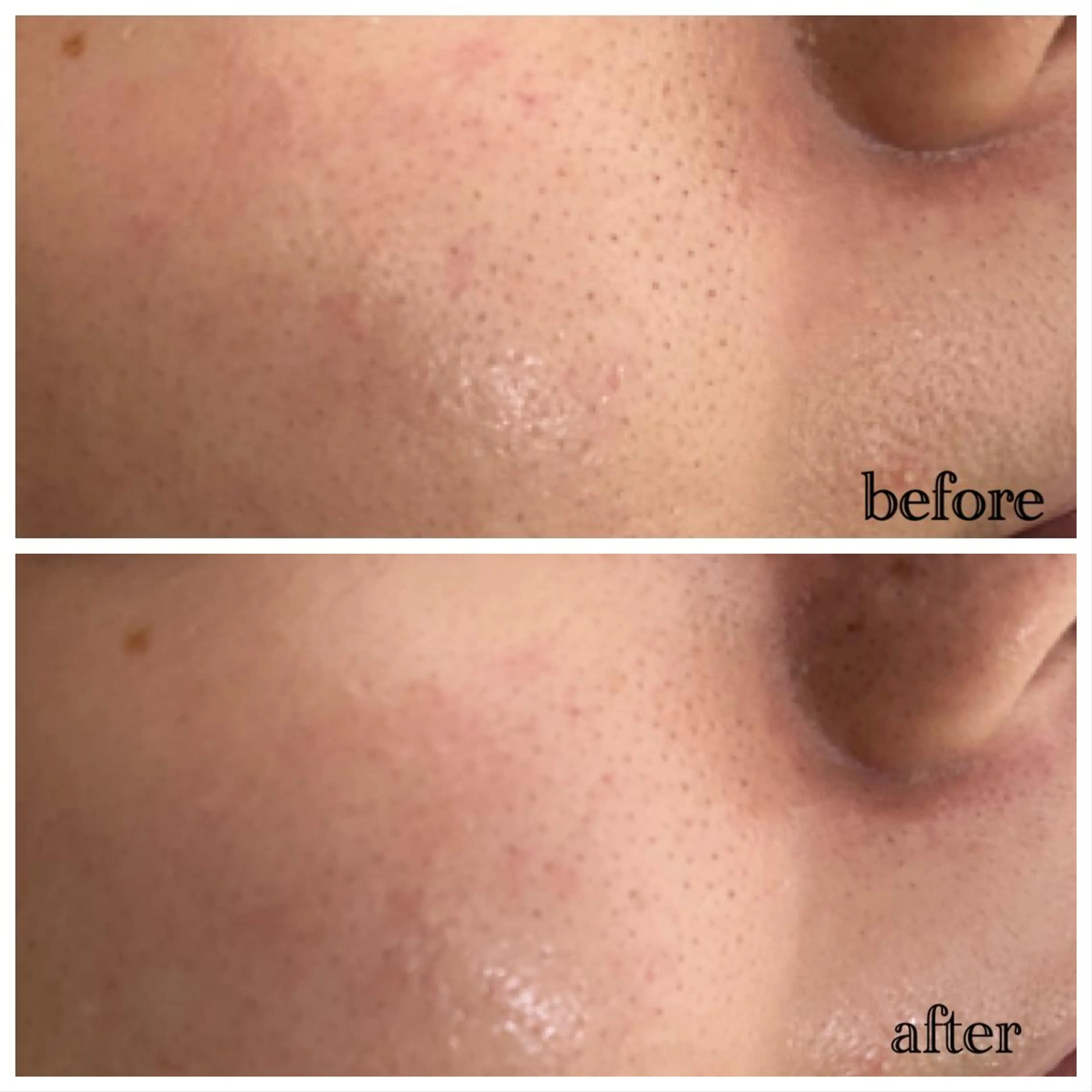 デ・アイム新潟北所属・サイトウ .のエステ・リラクイメージ