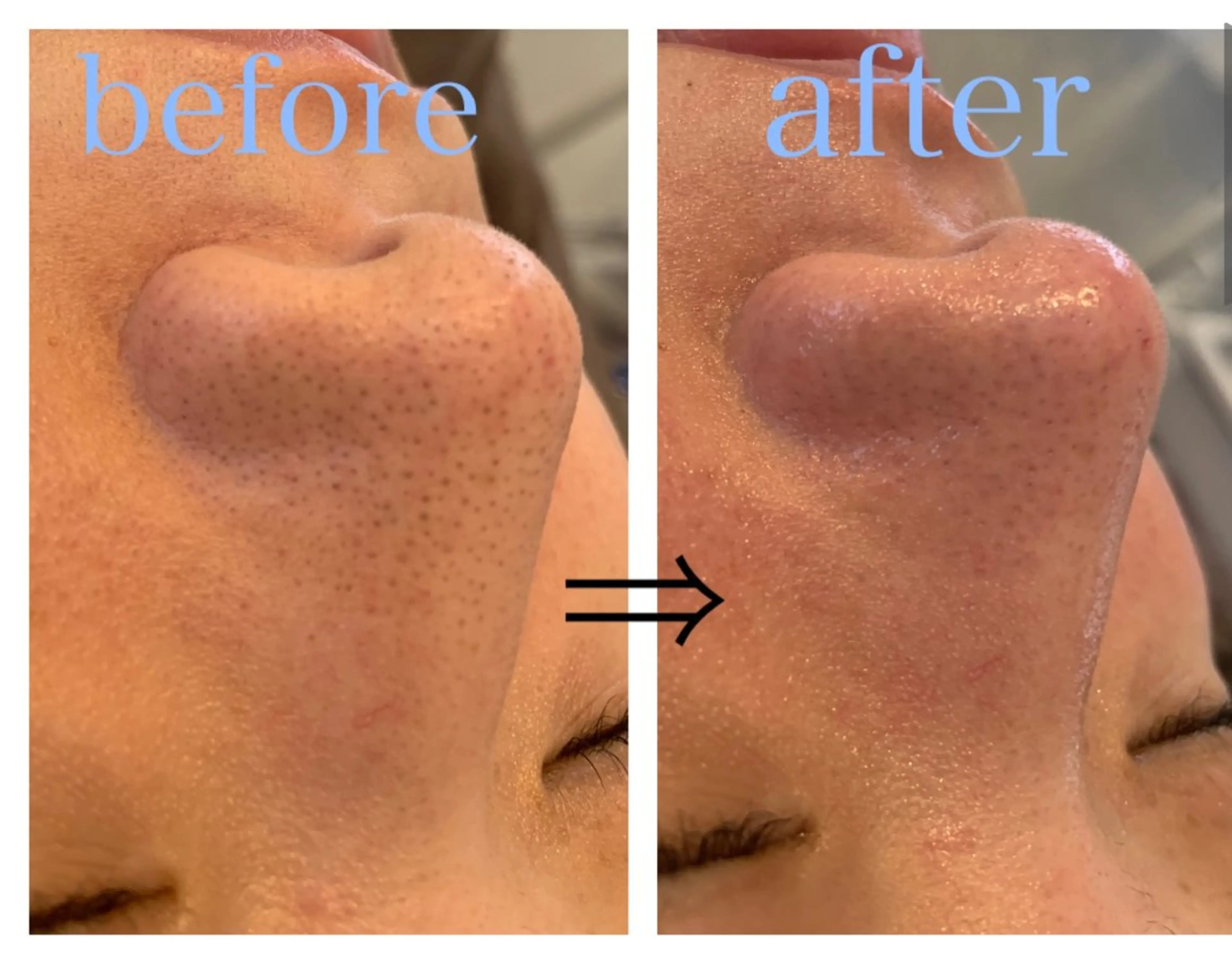 リジュベ所属・Rejuve ﾘｼﾞｭﾍﾞのエステ・リラクイメージ