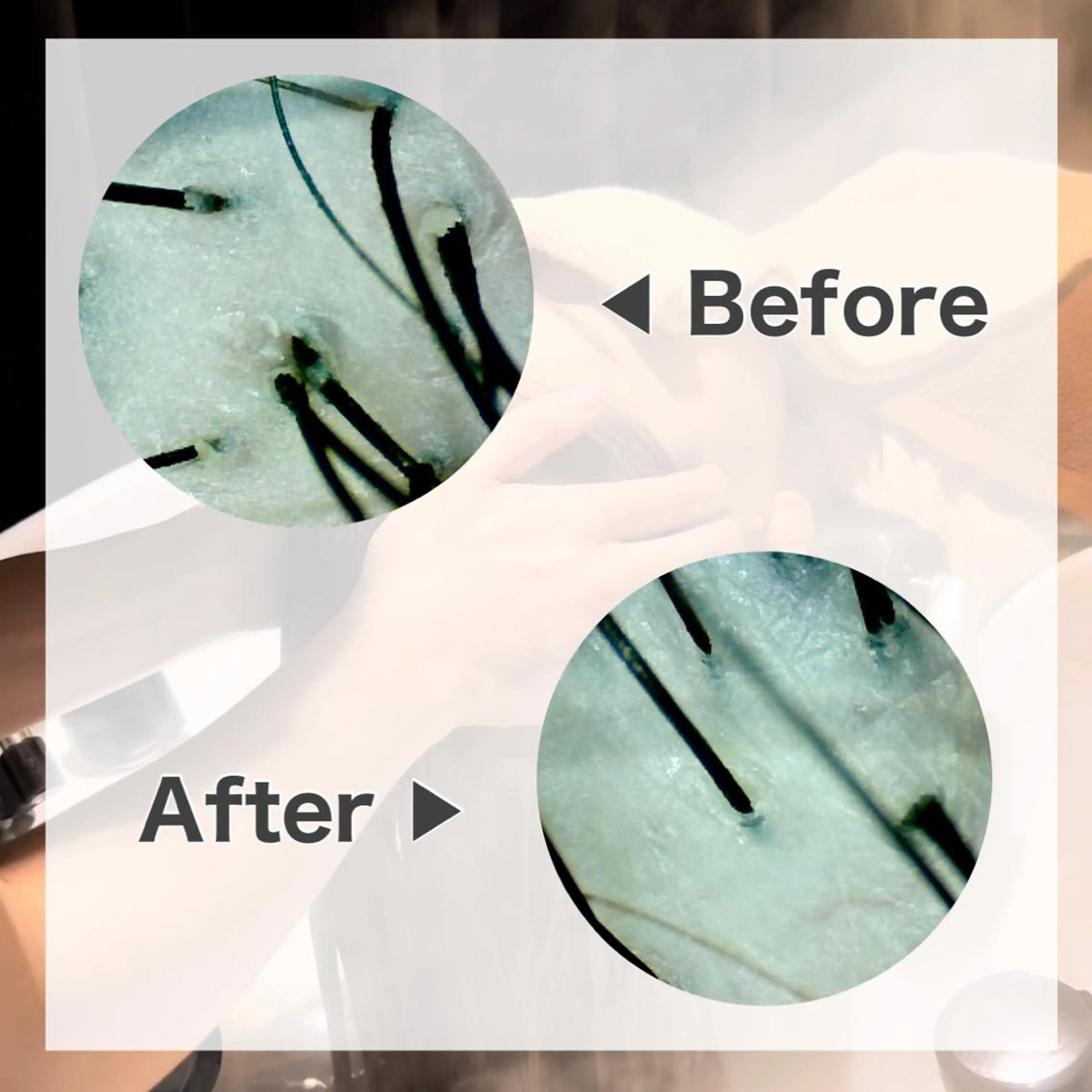 ミディアム 髪質改善 縮毛矯正 トリートメント 美髪ヘッドスパ🫧 西山紗奈江💆♀️のヘアスタイル