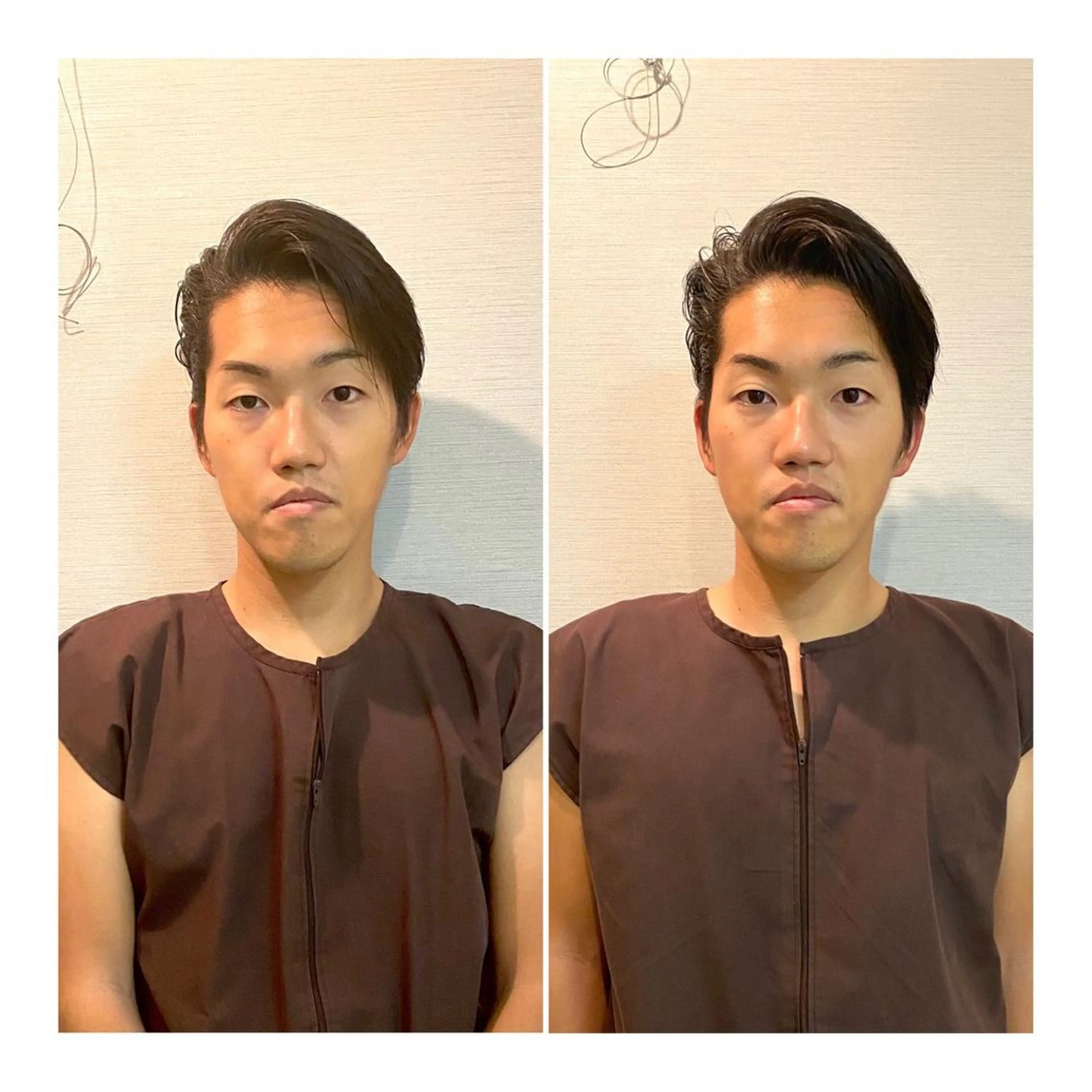 その他 即小顔♥️美容鍼× ハーブピーリングのその他イメージ