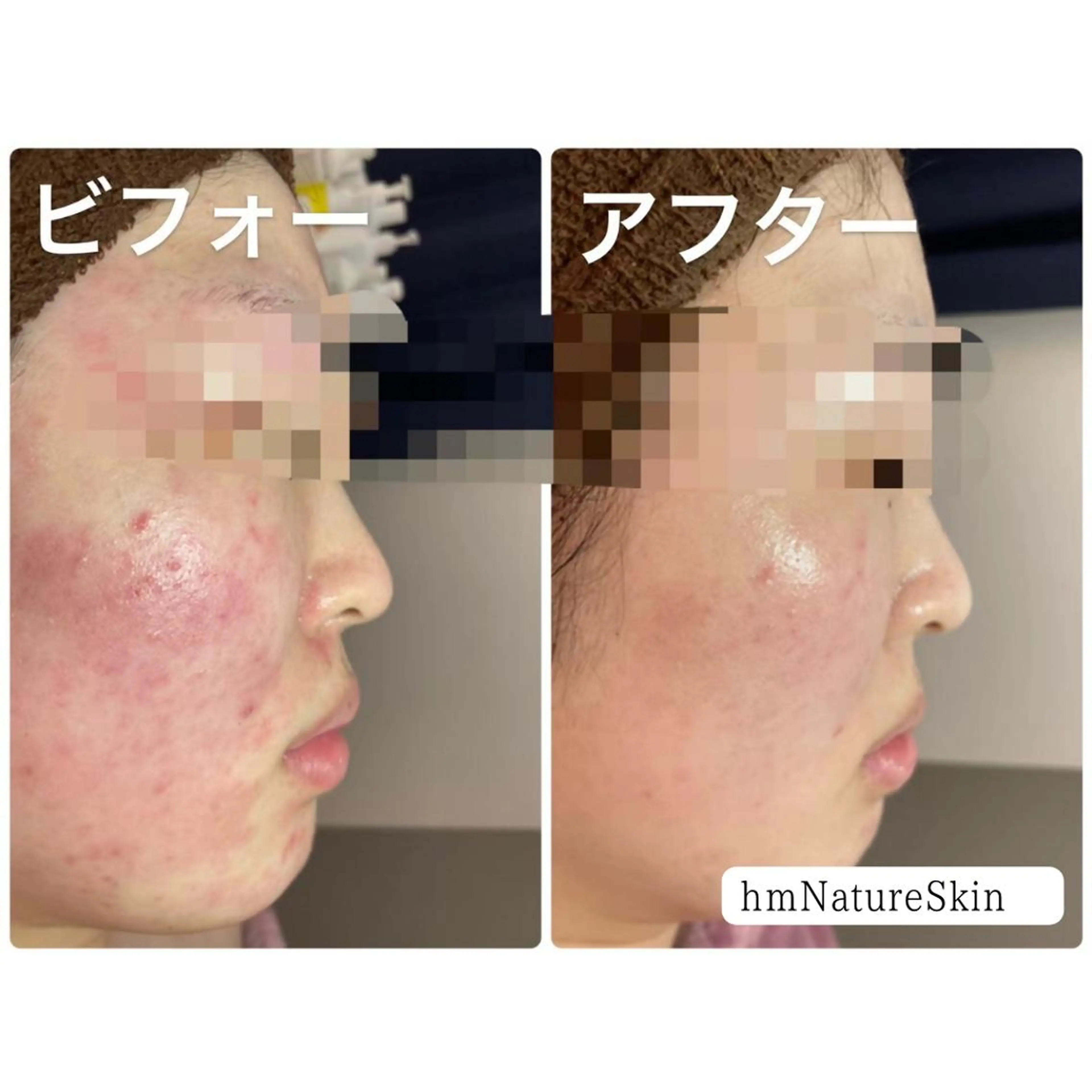 hm NATURESKINのエステ・リラクイメージ