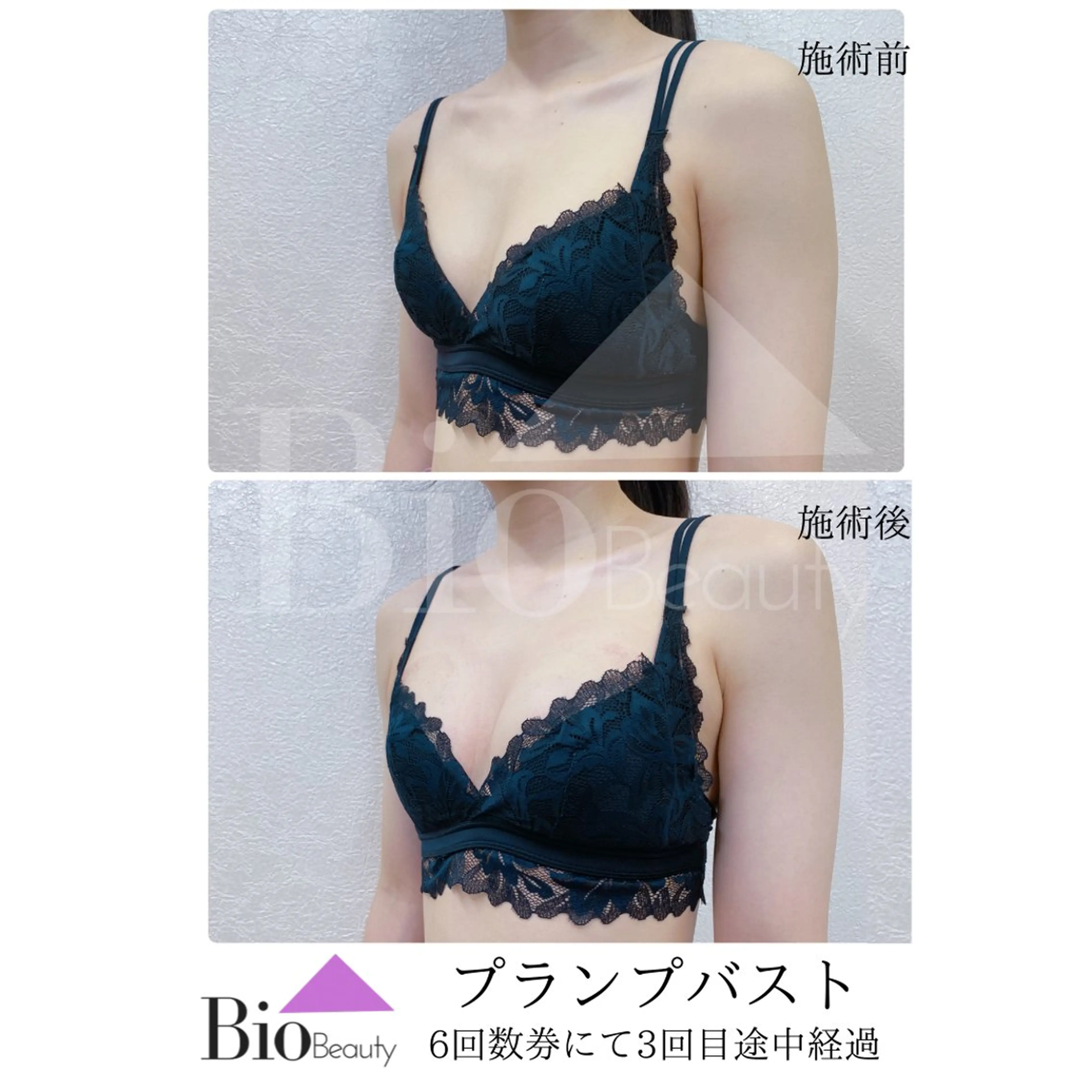 エステ Bio Beauty 神戸本店所属・エステ豊胸マイスター 中前のエステ・リラクイメージ