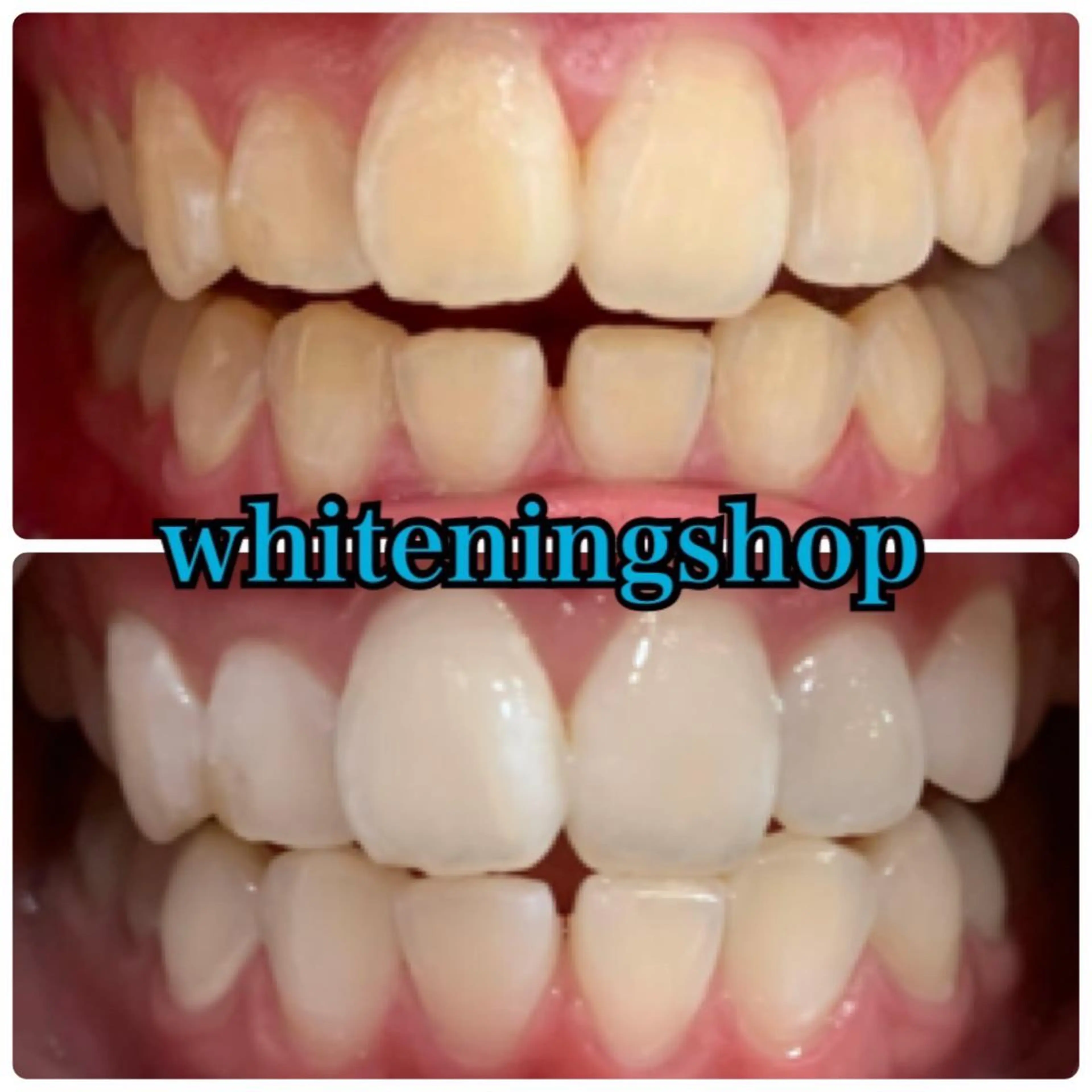 その他 ホワイトニングショップ金沢所属・ホワイトニング ショップ金沢のその他イメージ