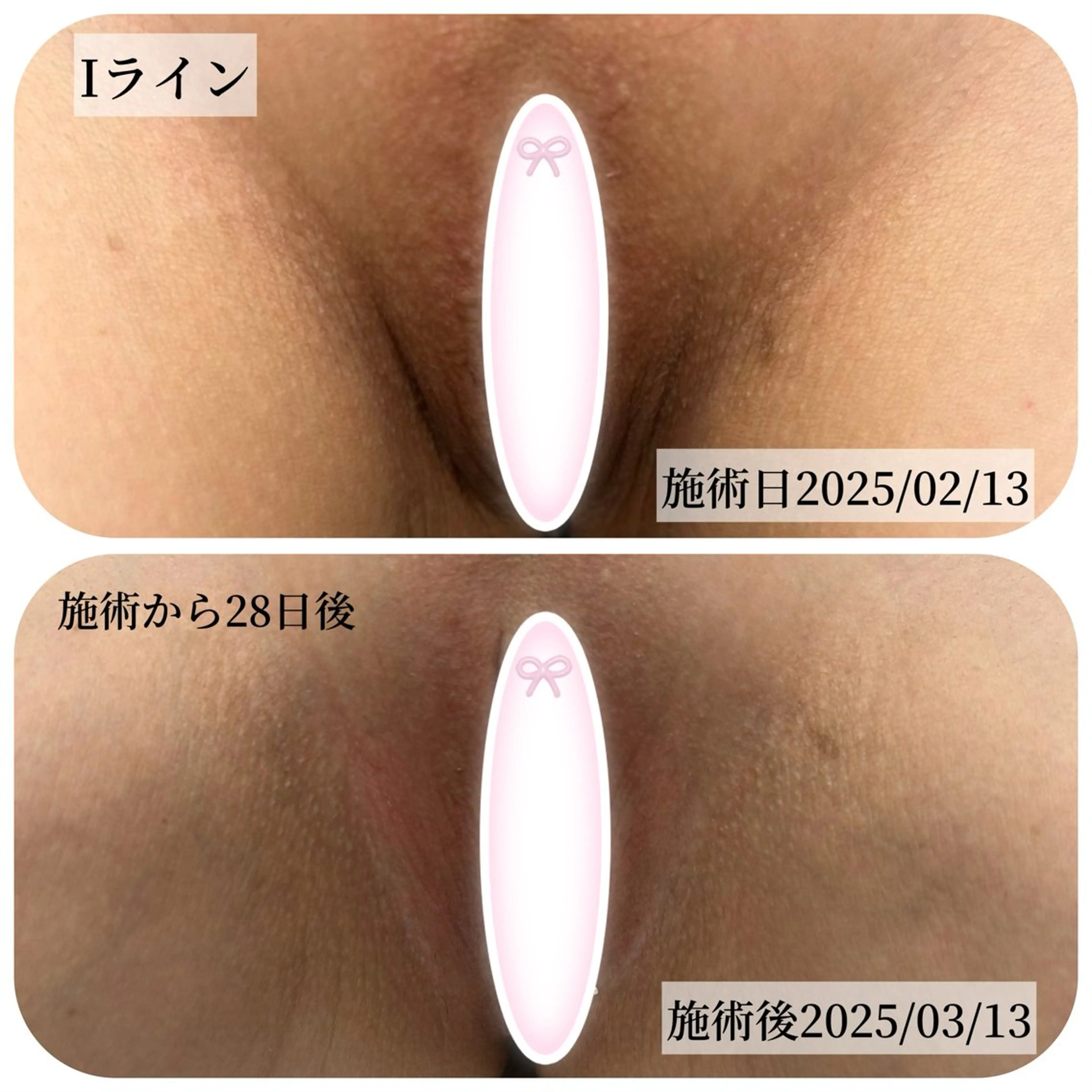 その他 Salon ALLIUM 恵比寿のエステ・リラクイメージ