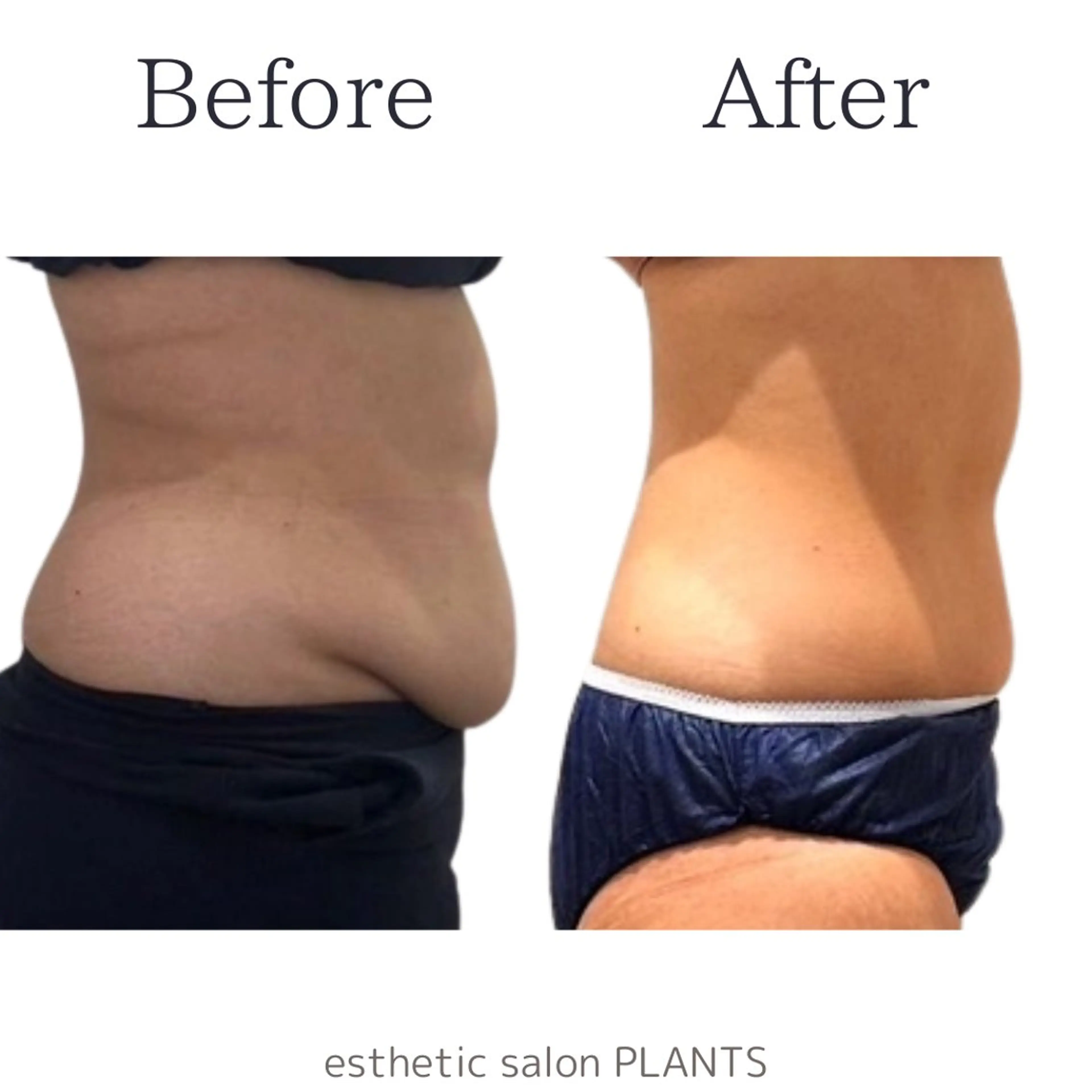 エステ esthetic salon PLANTS所属・エステティックサロン PLANTSのエステ・リラクイメージ