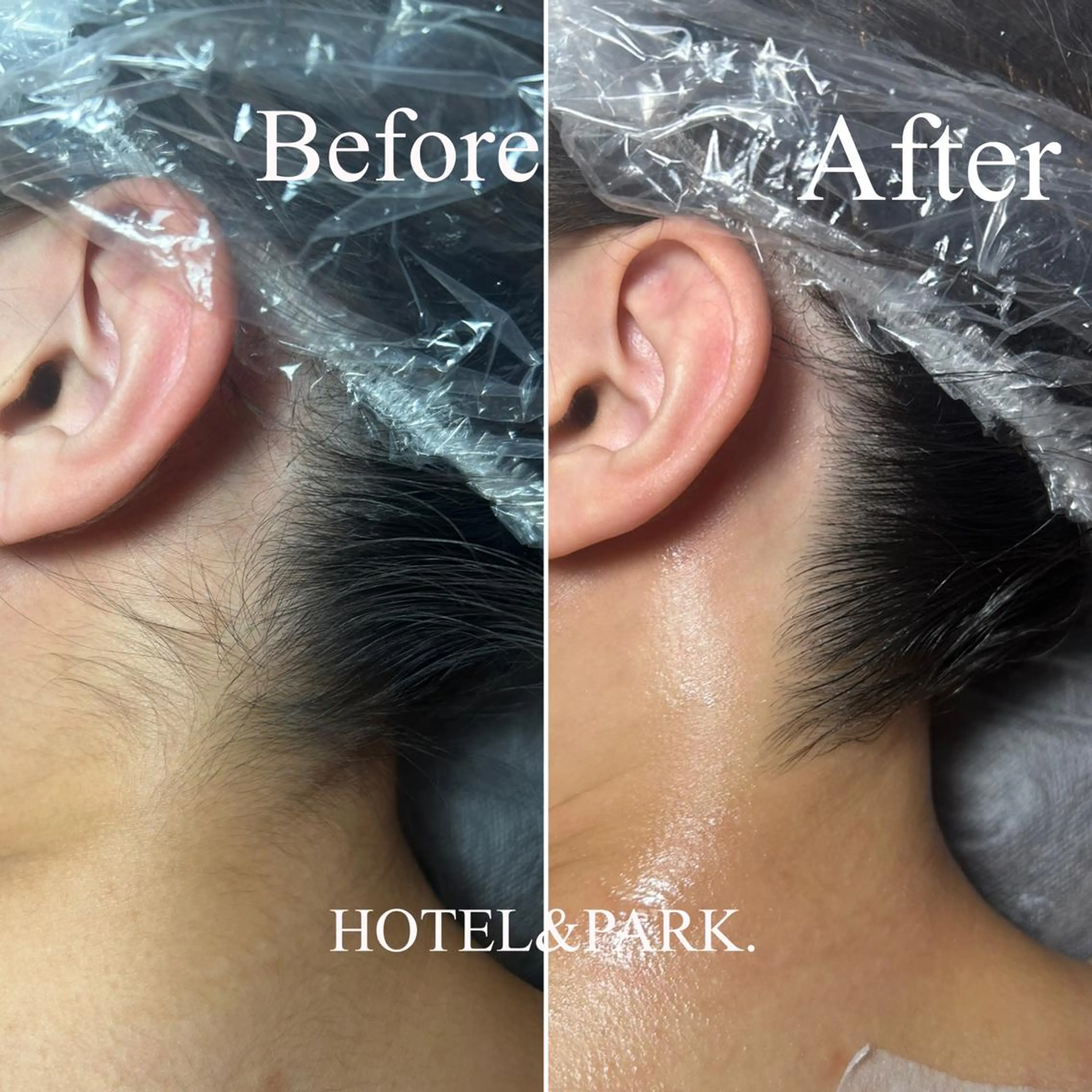 HOTEL&PARK . ワックス脱毛のエステ・リラクイメージ