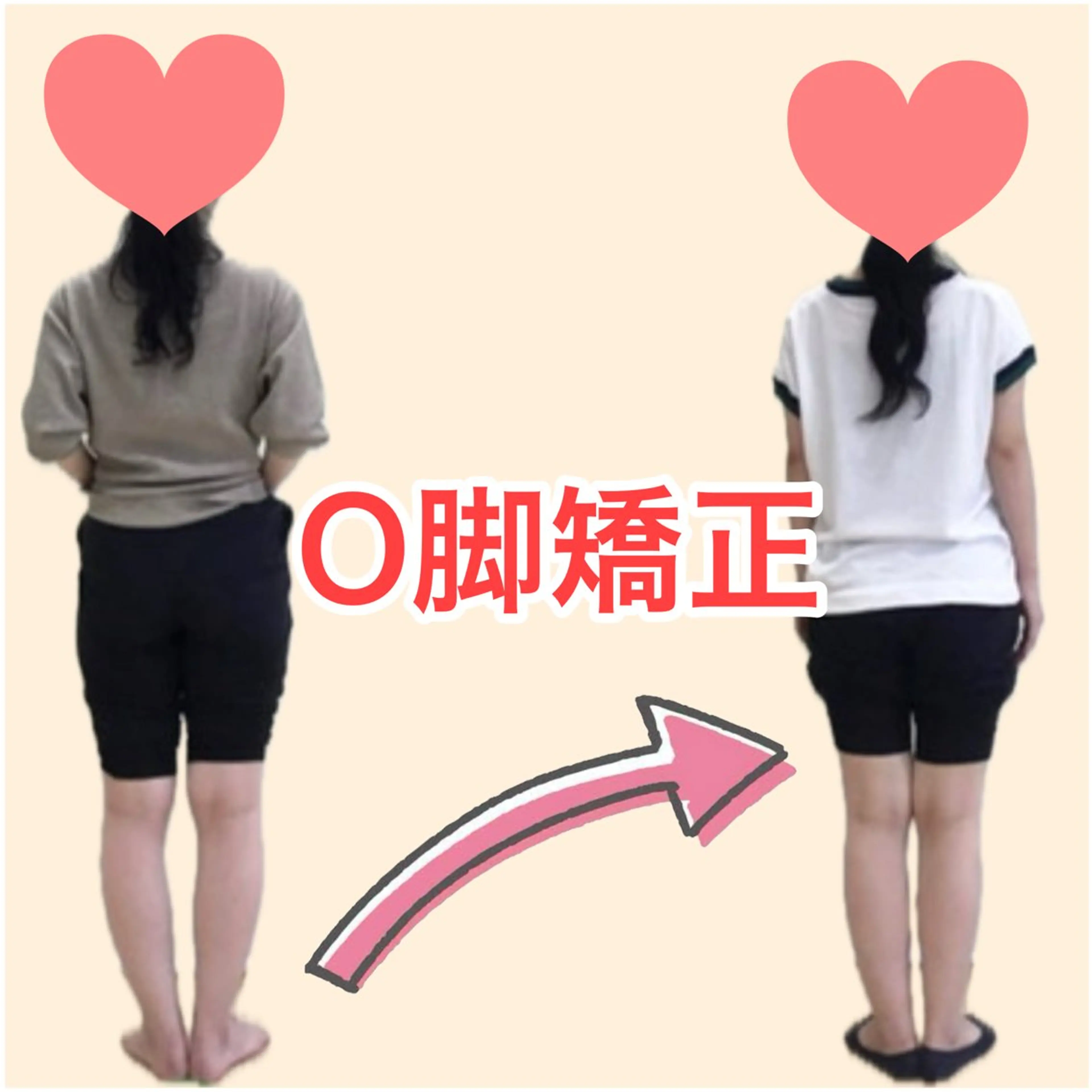 産前産後骨盤矯正・ダイエット専門こんだ整骨院所属・産前産後専門院 こんだ整骨院のエステ・リラクイメージ