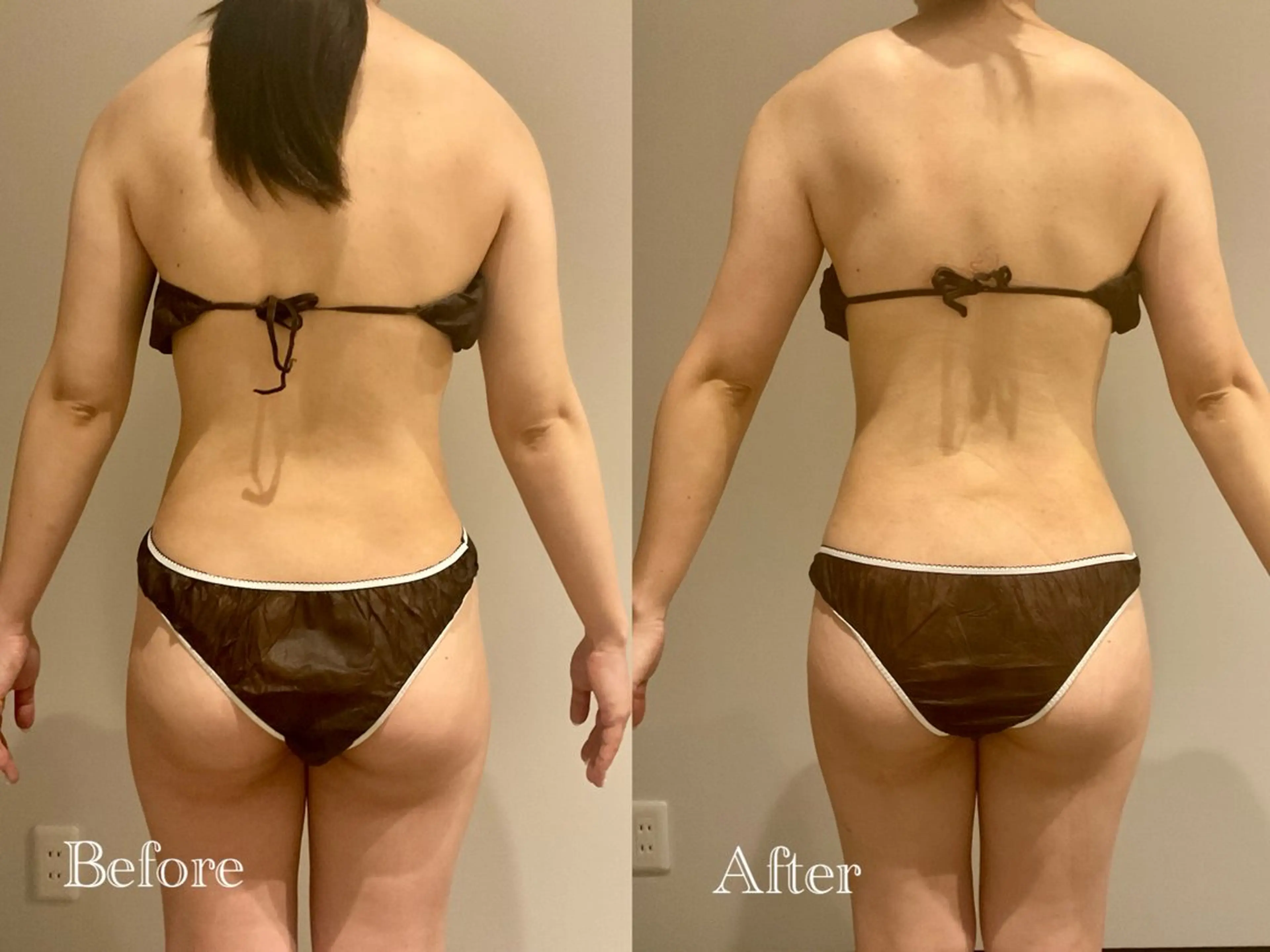 エステ リラク Esthetic MiEUXのエステ・リラクイメージ