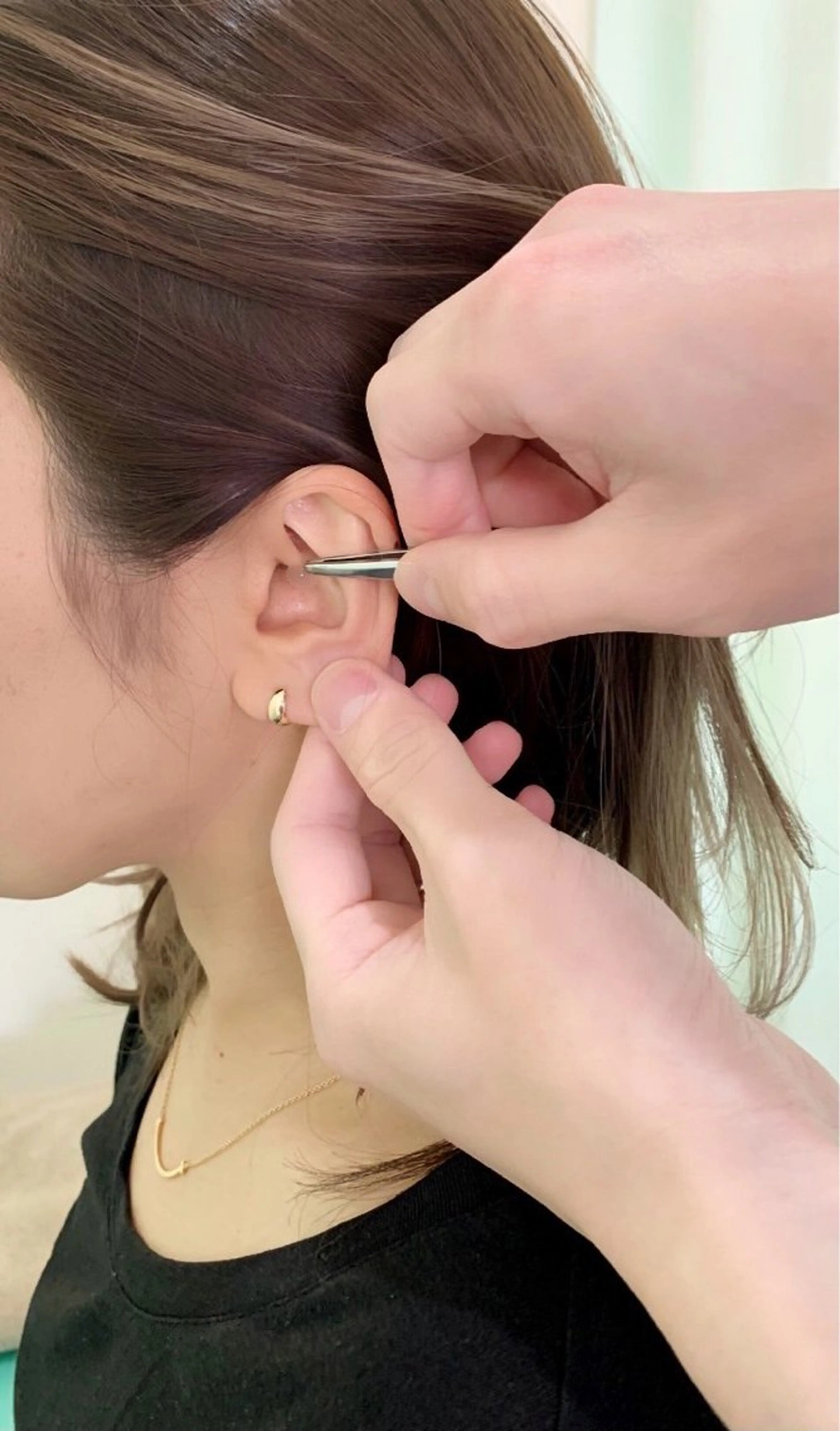 【耳ツボ4回セット✨】1週間に1回の貼り替えで👍耳ツボを刺激することで食欲減退・胃腸の調子整えます🙌の写真