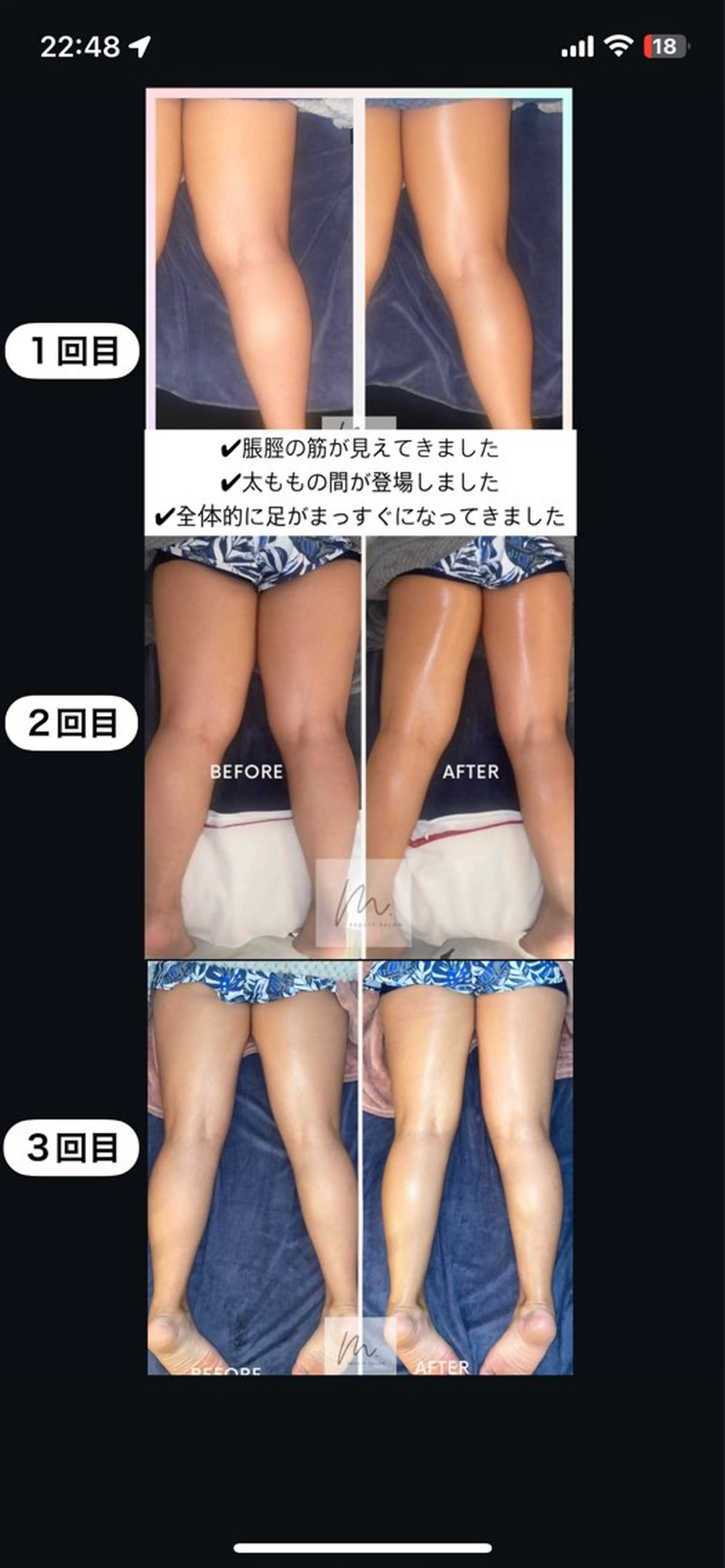 SHARES MADOKAのエステ・リラクイメージ