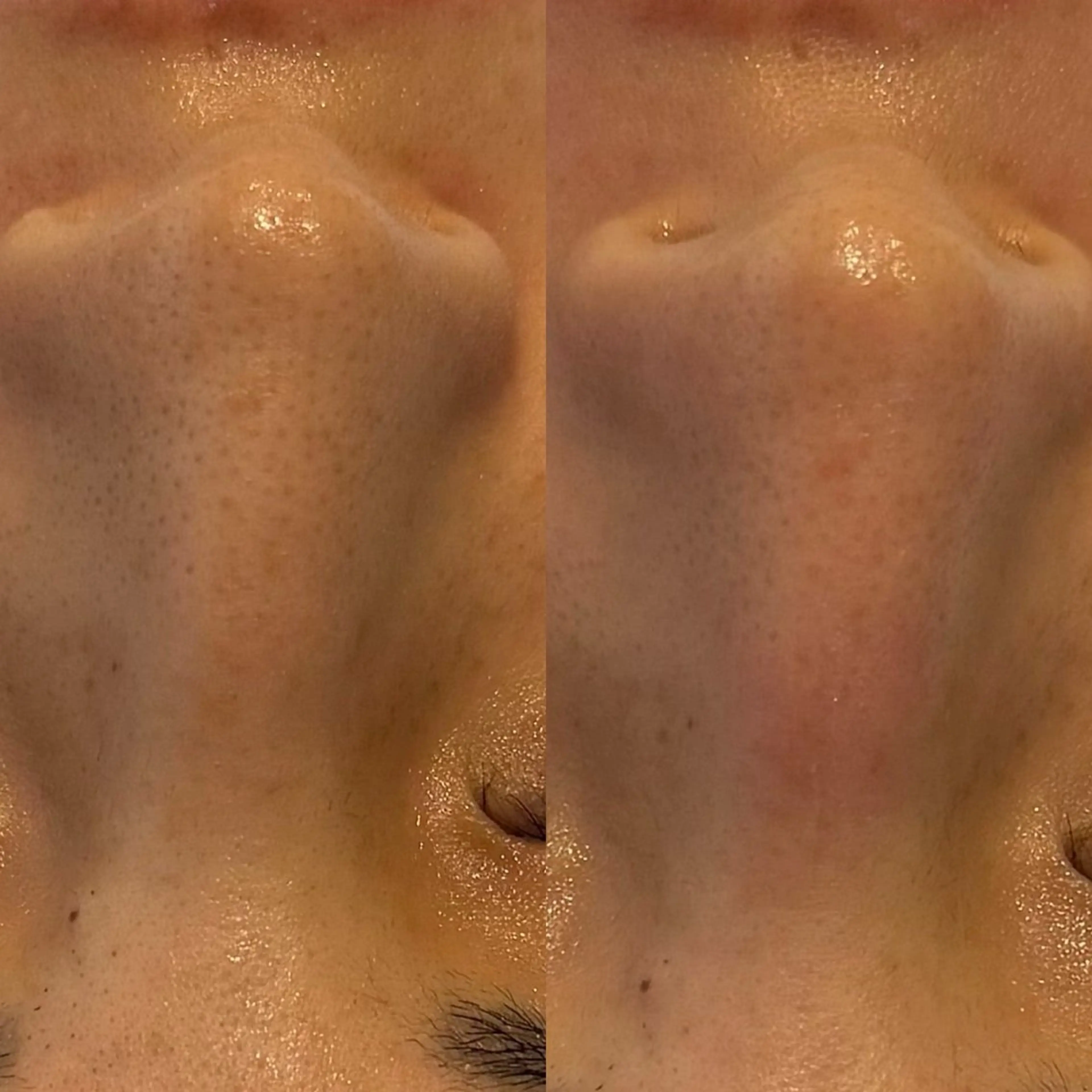 エステ リラク salon aretéのその他イメージ