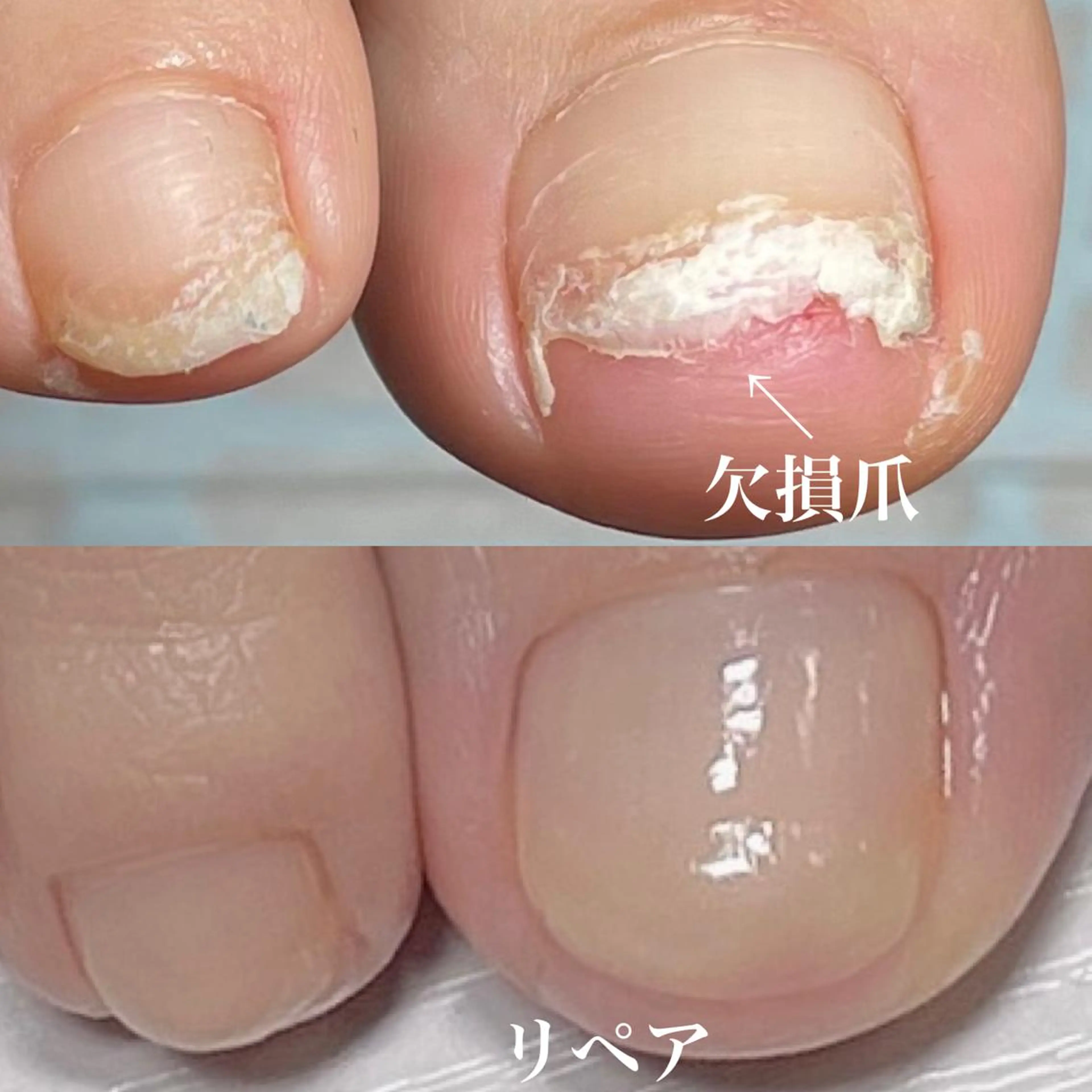 ネイル クリアネイル フットネイル ジェルネイル .Nails Mio 赤羽西ネイルサロンのネイルデザイン