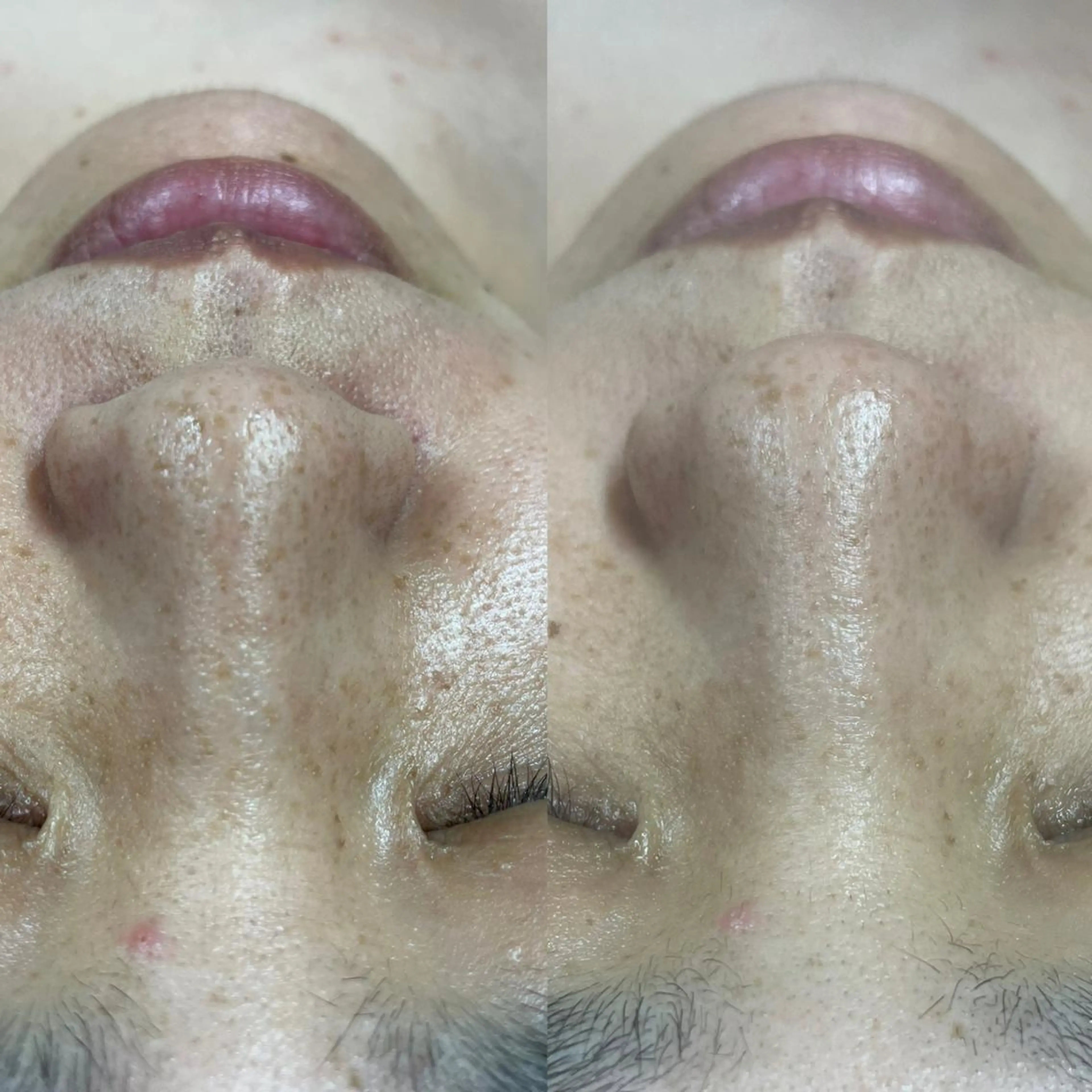 瑞穂区丸の内メナード 横山ともみのその他イメージ