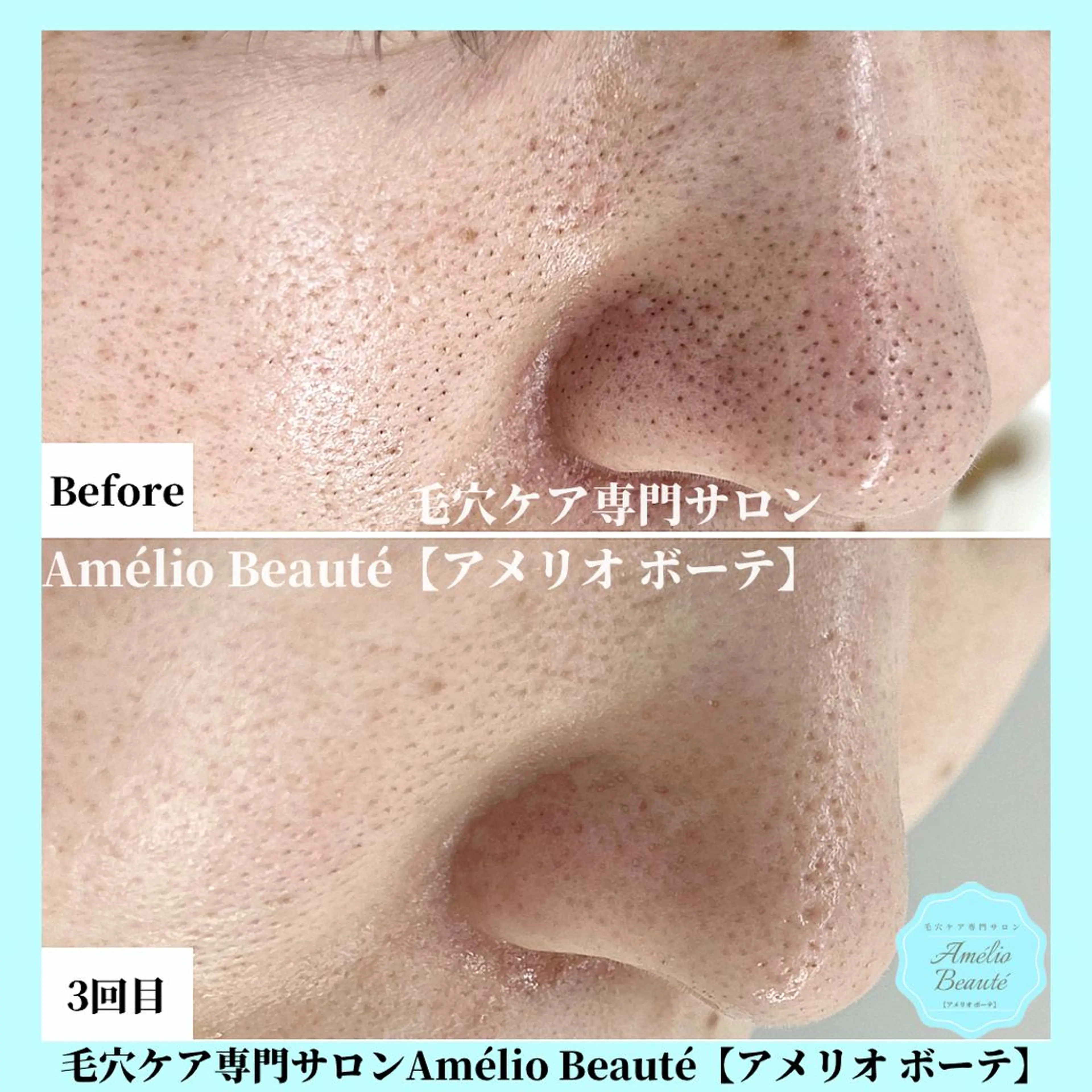 毛穴ケア専門サロン Amélio Beauté所属・毛穴ケア専門サロン アメリオボーテのその他イメージ