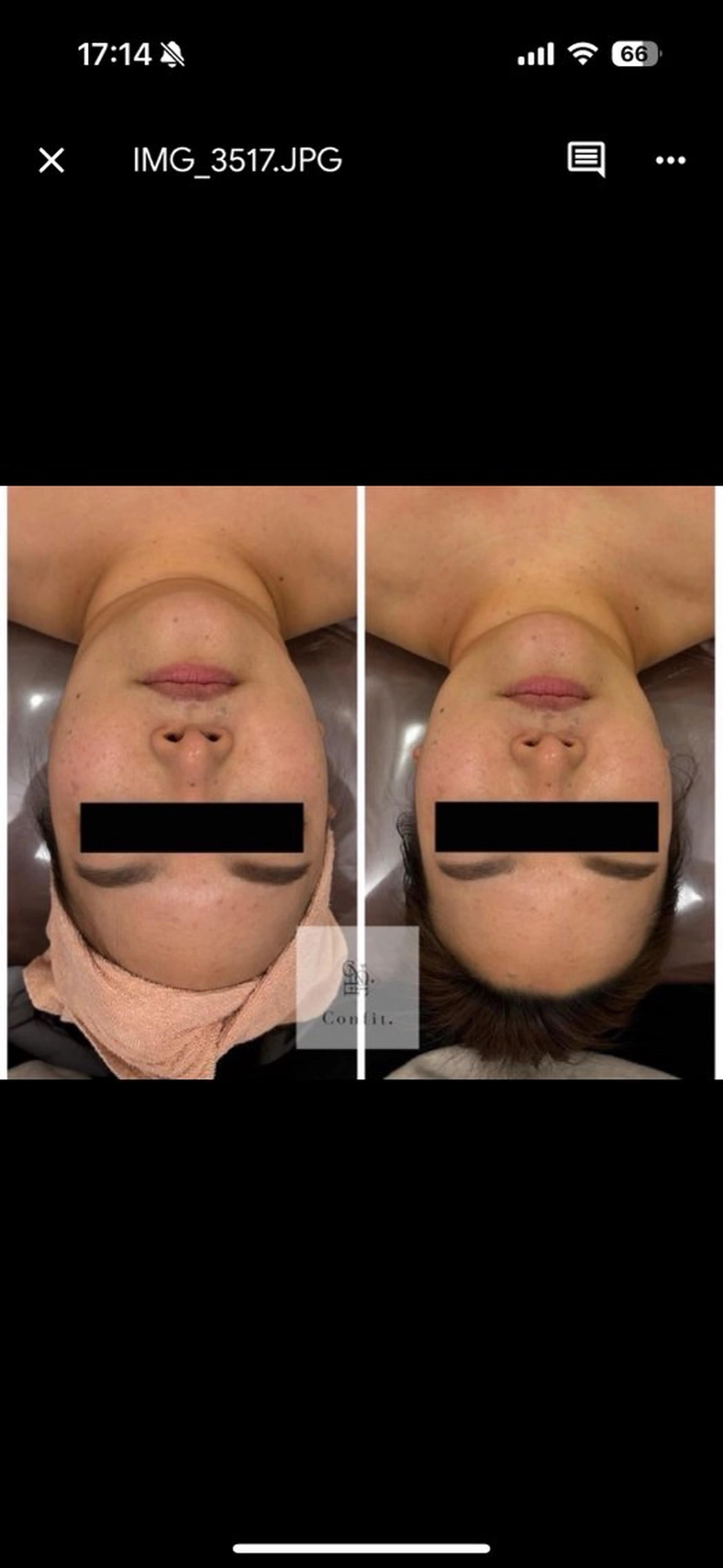 その他 Micell beauty所属・Micell beautyのエステ・リラクイメージ