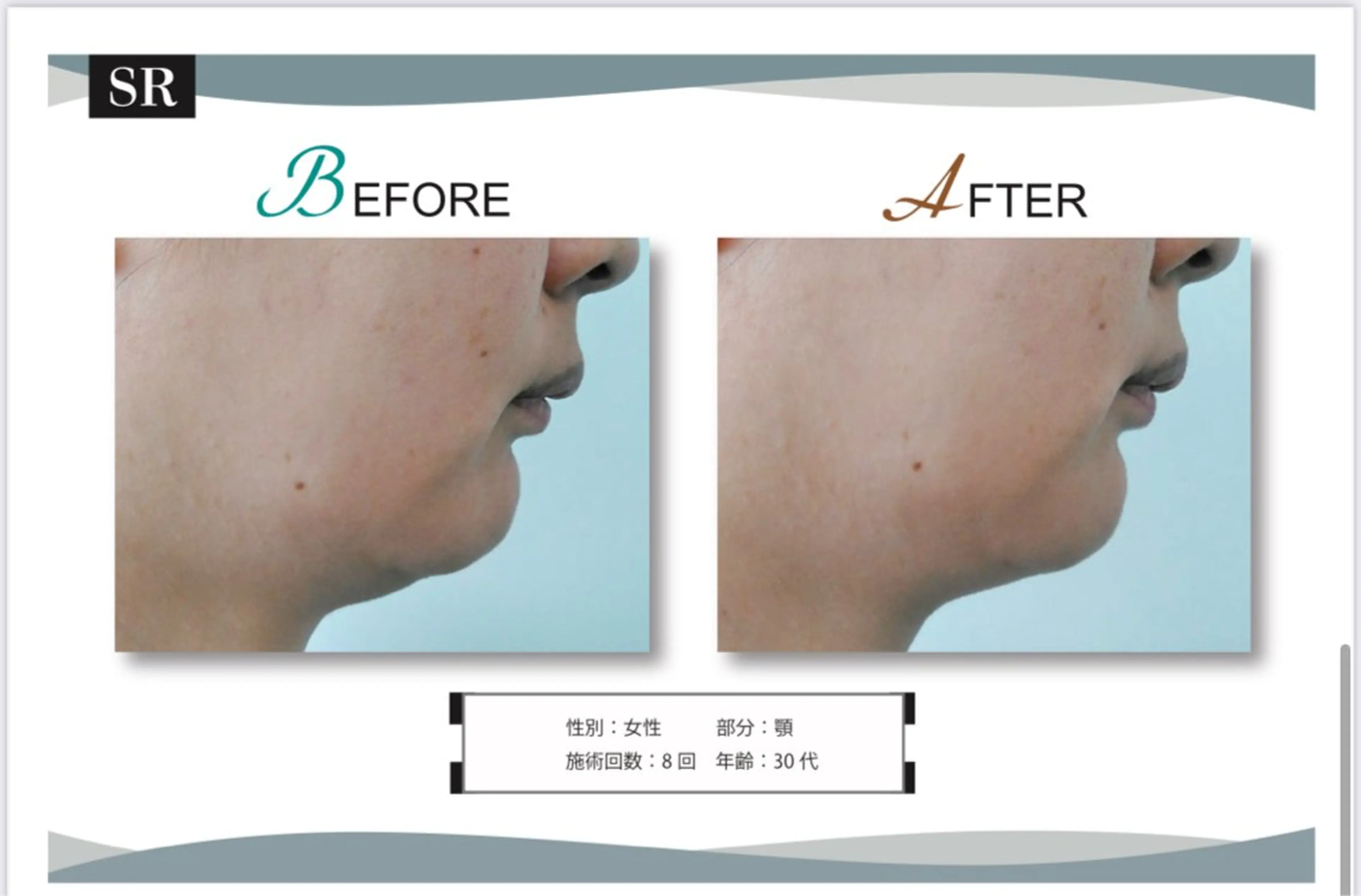 脱毛サロン　LILIAN所属・脱毛・美肌サロン LILIAN 脱石油のエステ・リラクイメージ