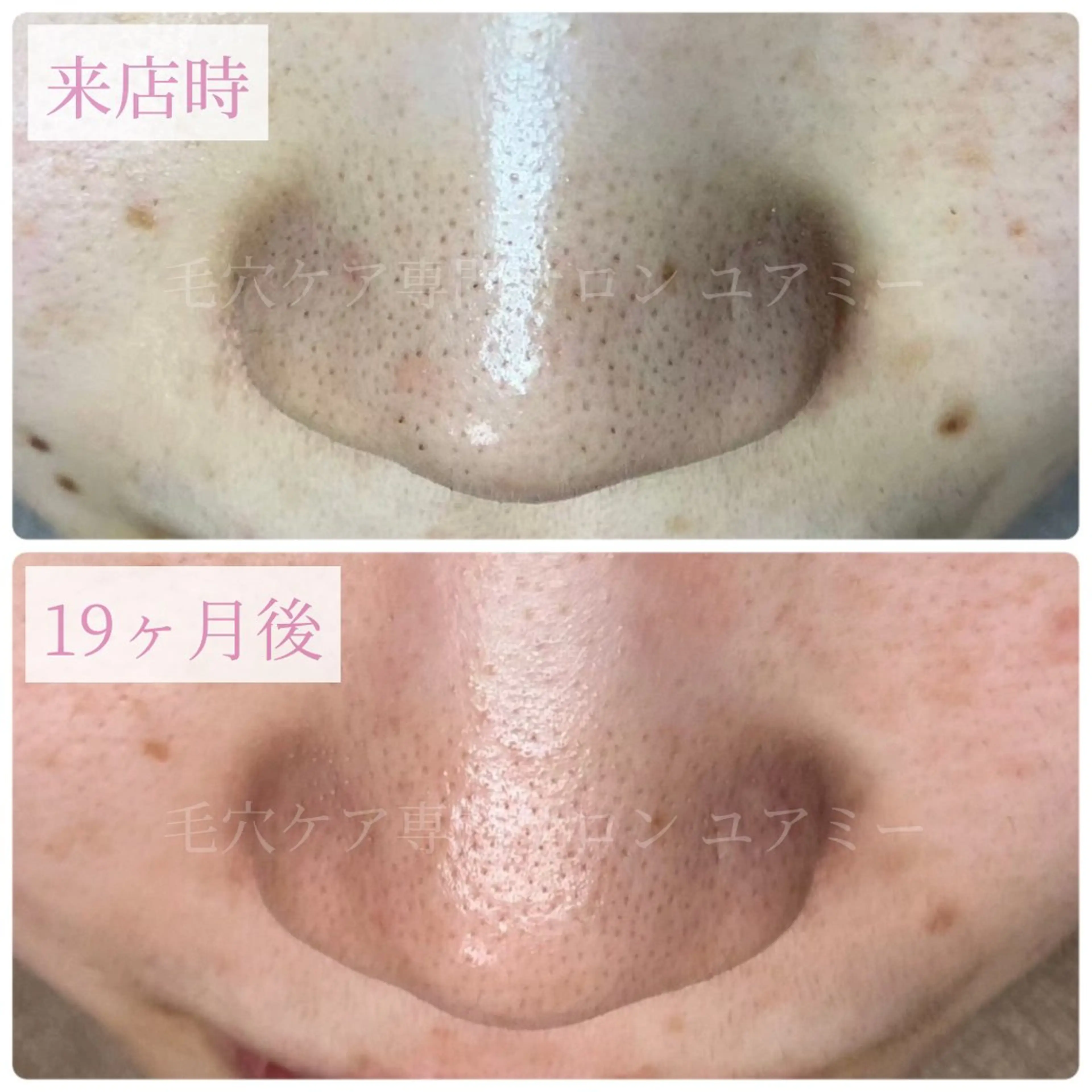 エステ リラク 毛穴肌質ケアサロン Yourmeユアミーのエステ・リラクイメージ