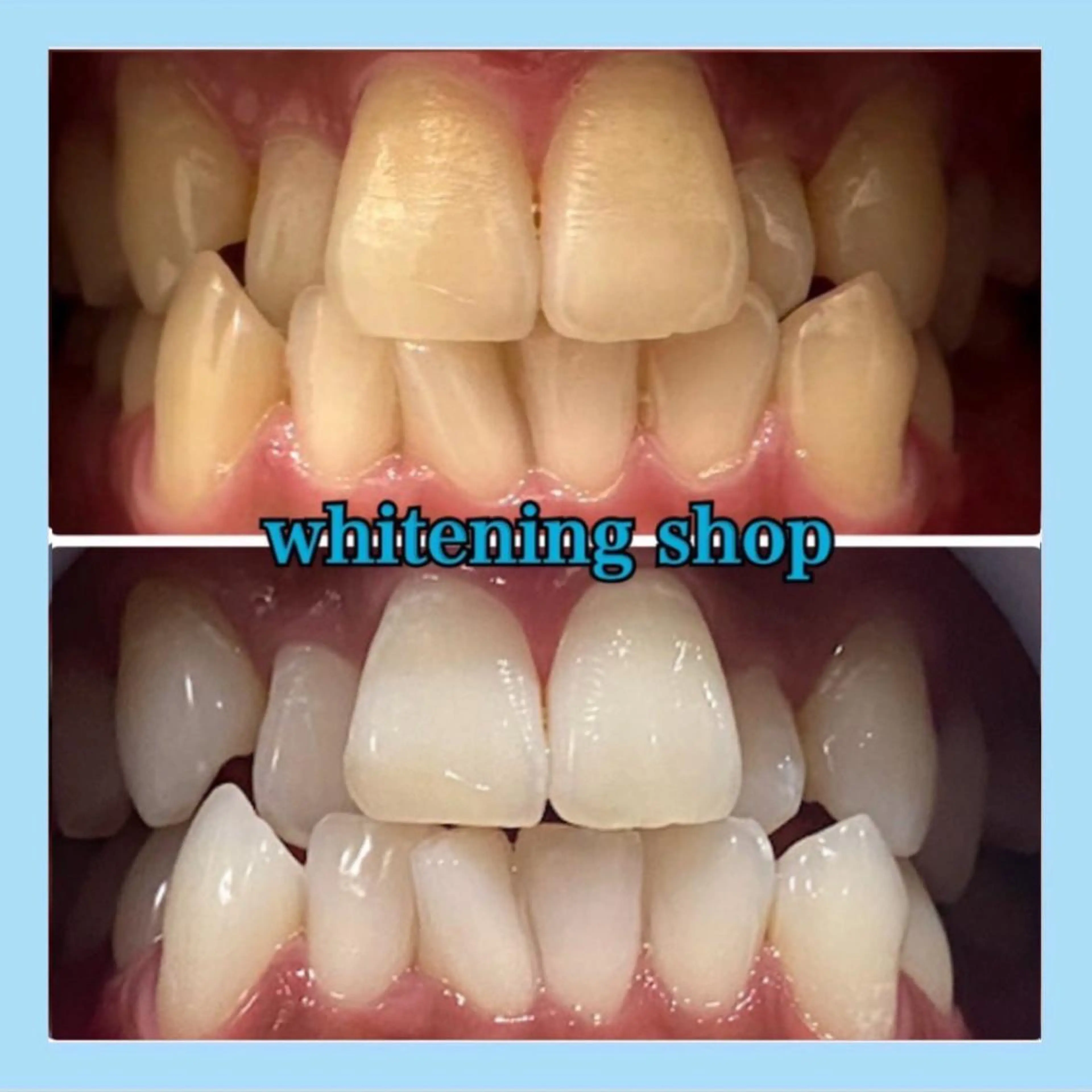 ホワイトニング ショップ千葉店のその他イメージ