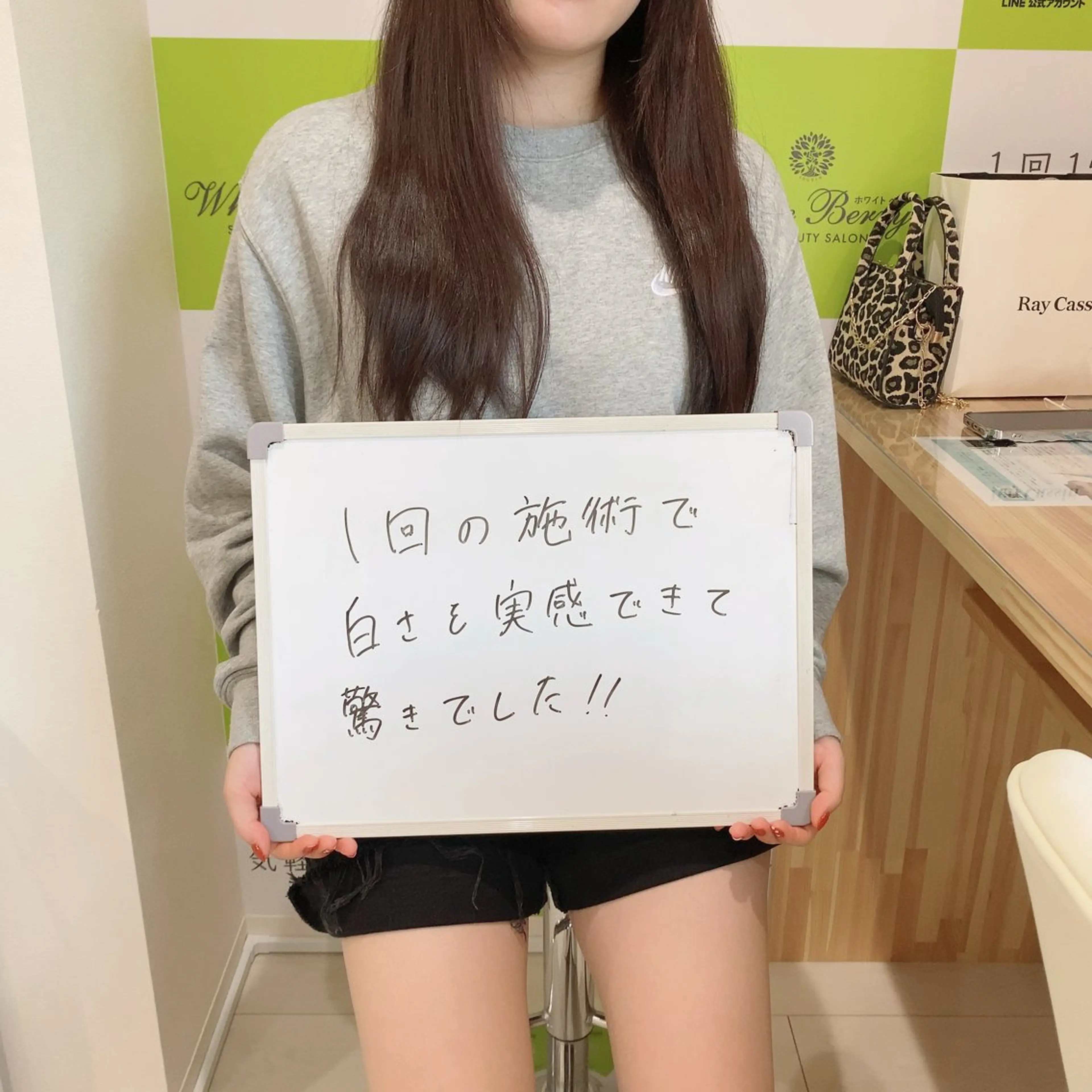 White Berry SELF BEAUTY SALON所属・セルフホワイトニング 🦷口元垢抜け✨のその他イメージ