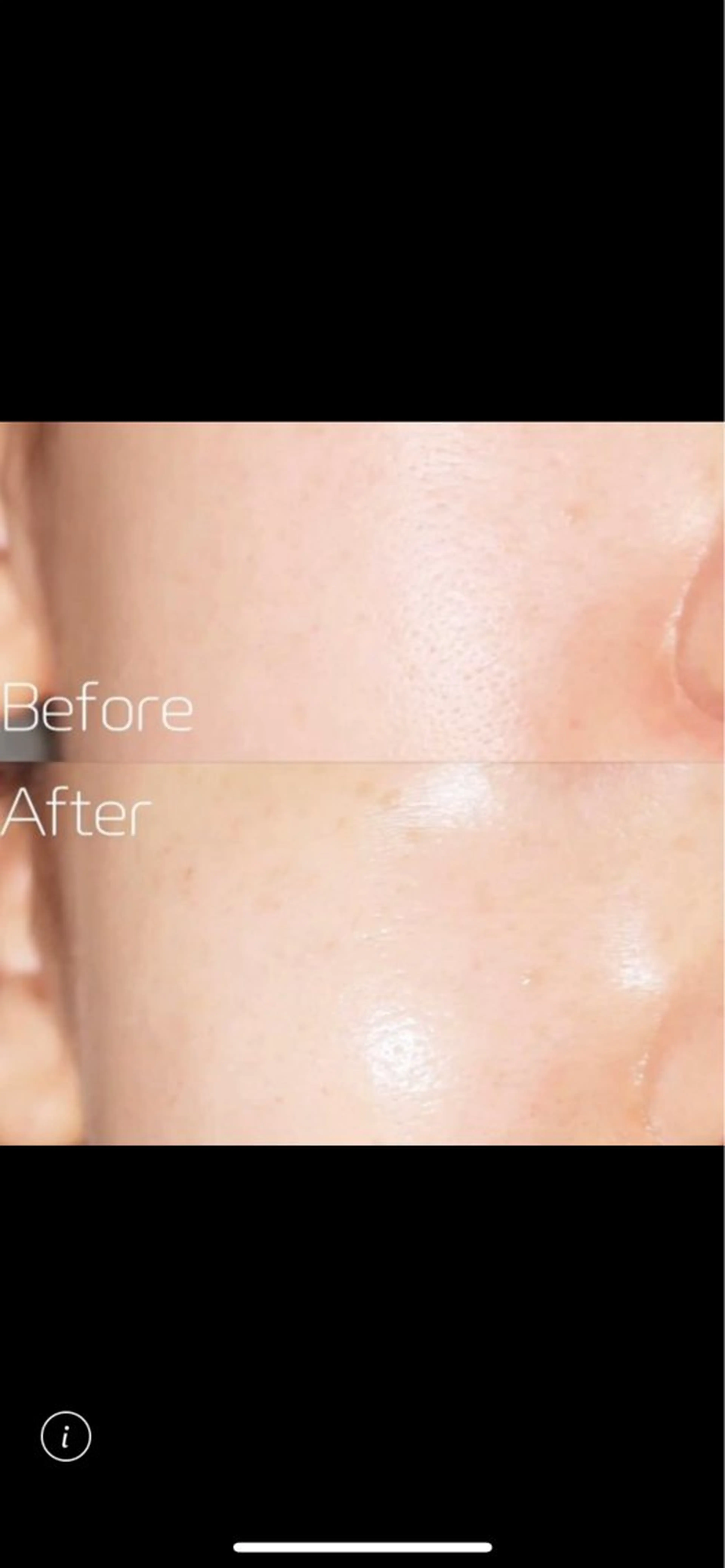 脱毛サロン　HUGME.所属・脱毛サロンHUGME 光フォトフェイシャルのエステ・リラクイメージ