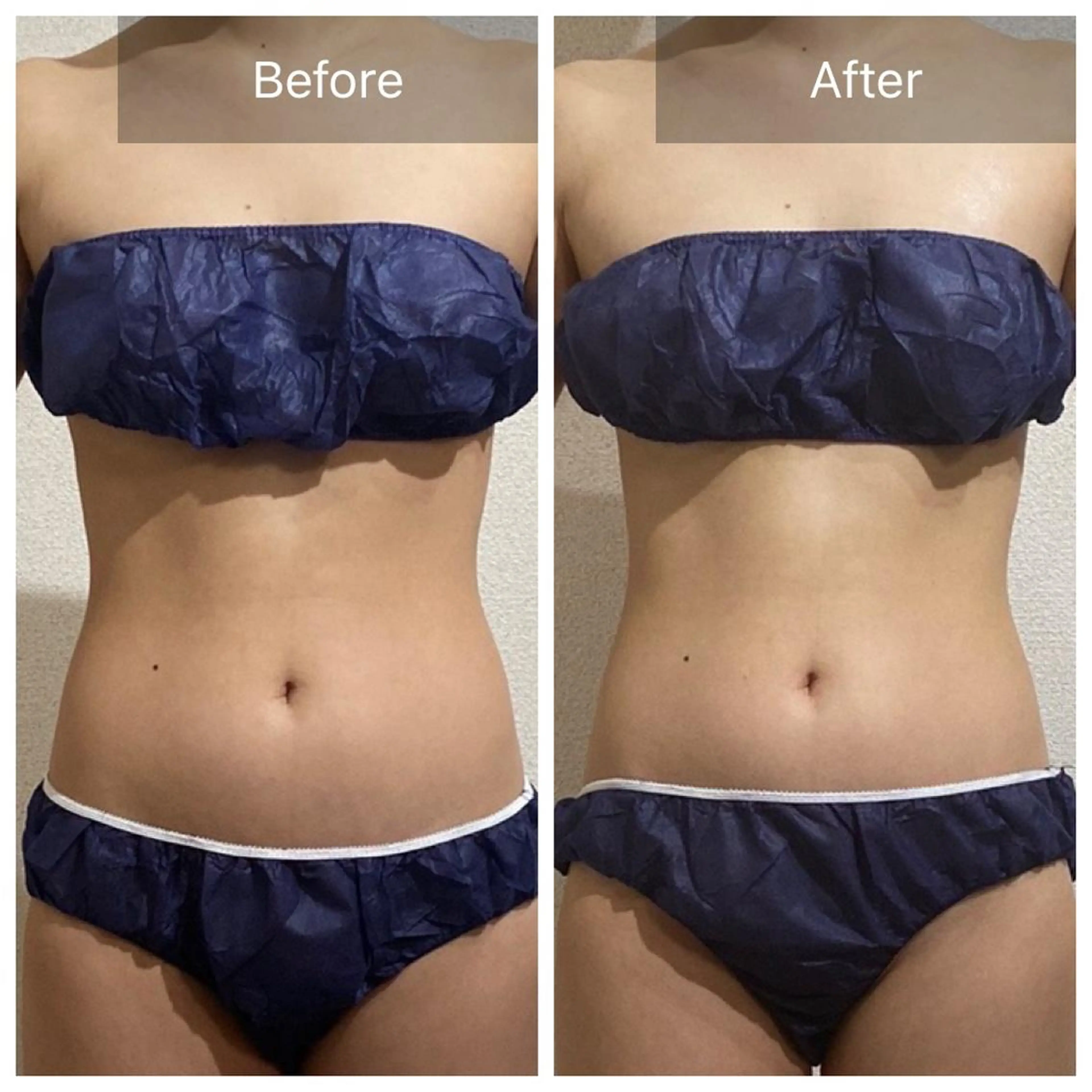 エステ リラク Bène Soin du Esthétique所属・逵中 元香のエステ・リラクイメージ