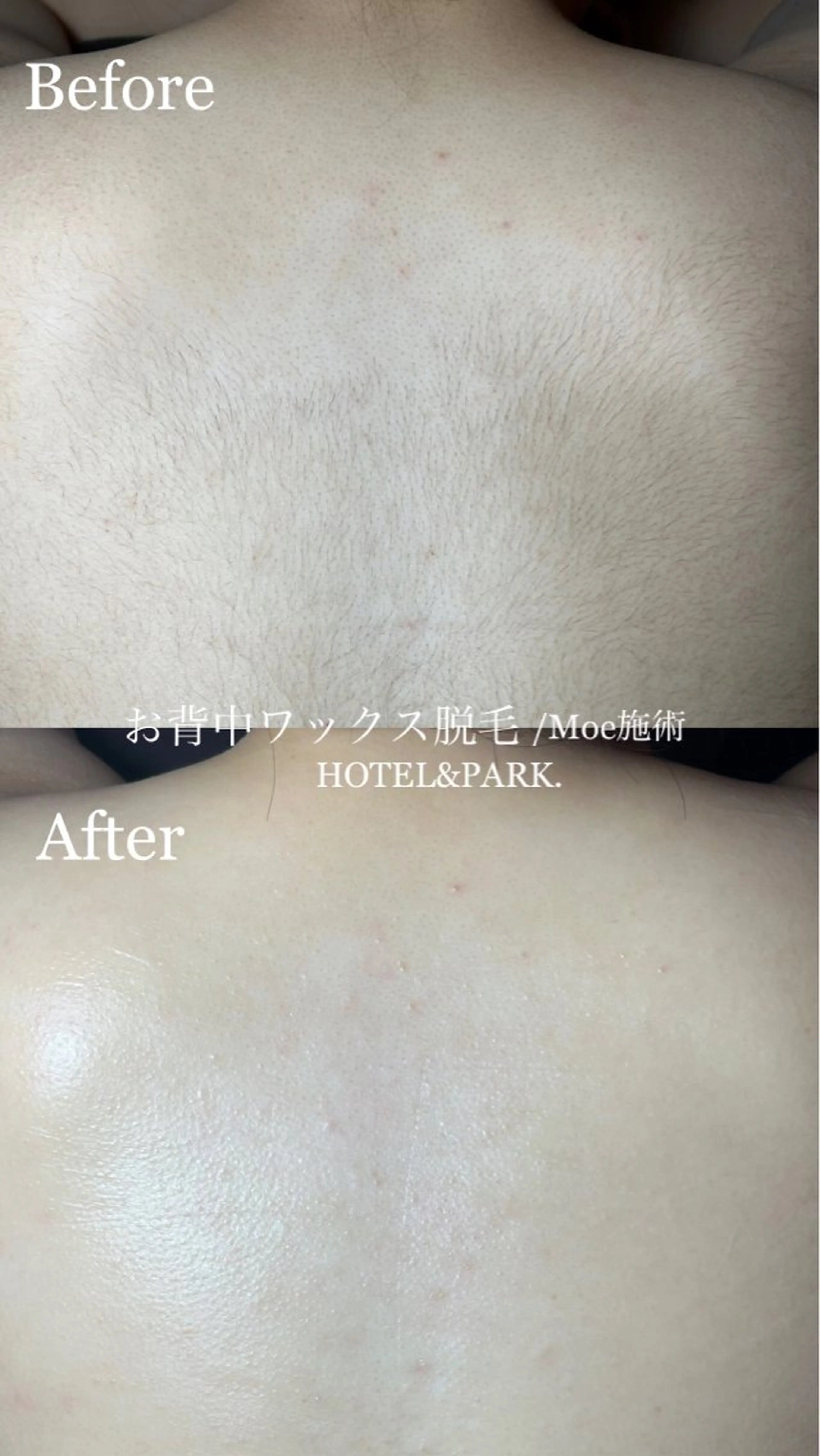 HOTEL&PARK .Moeワックス脱毛のエステ・リラクイメージ