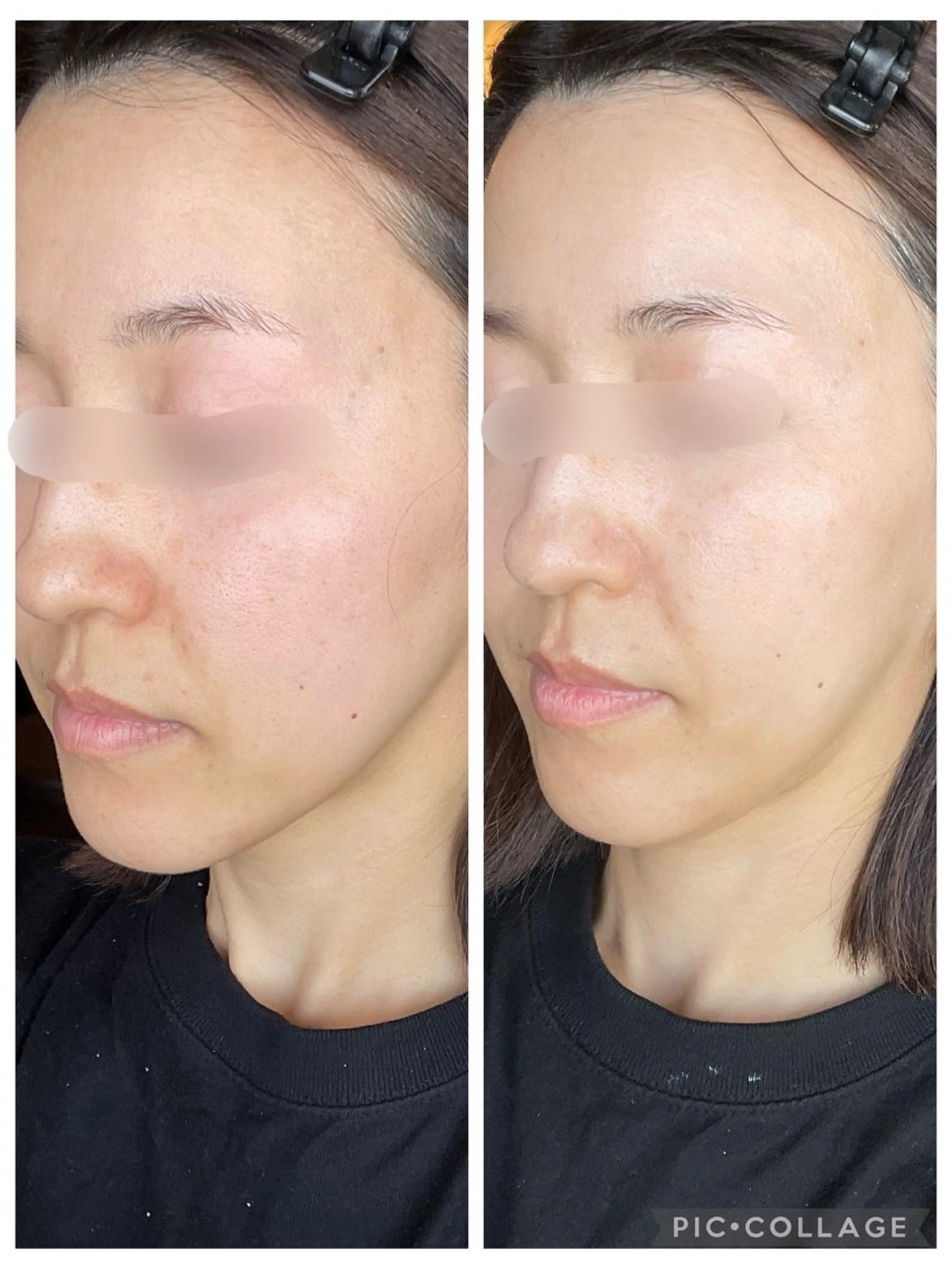 Sena Dewi所属・Sena Dewi SAE🌼のエステ・リラクイメージ