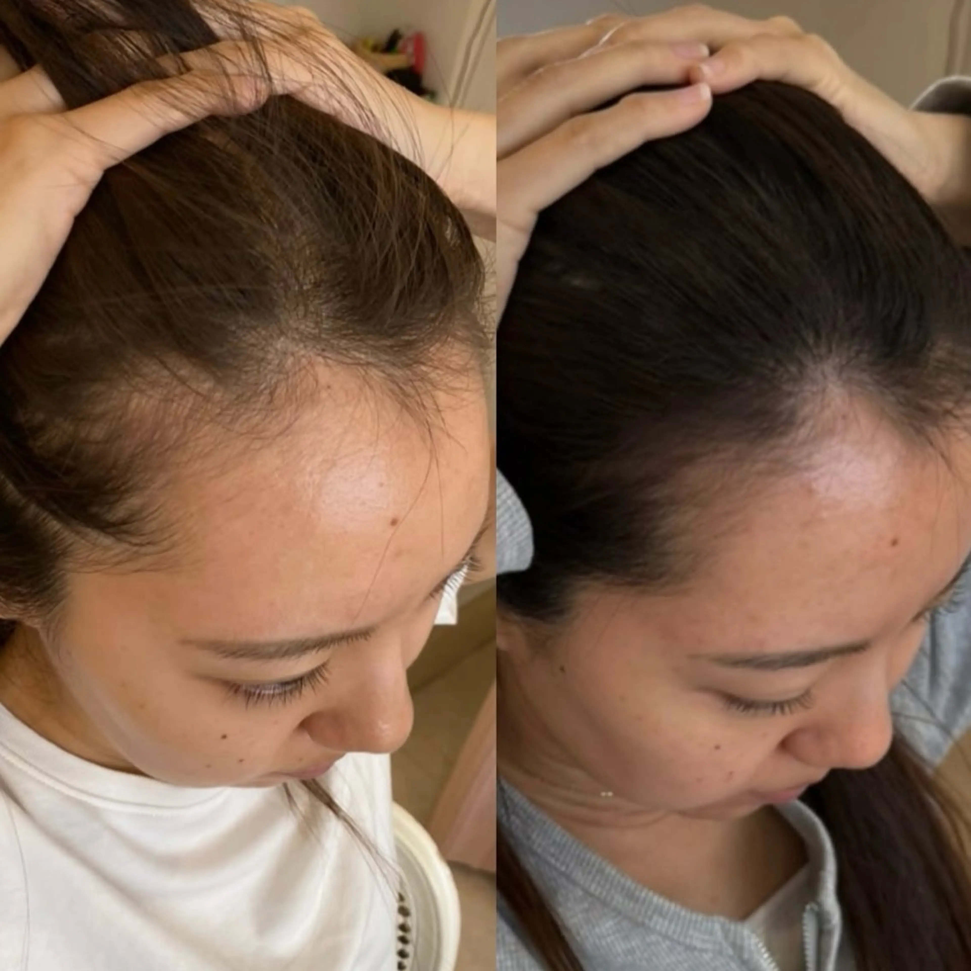 毛穴専門店MeMe.八千代店所属・\毛穴・頭皮/ のお悩みに特化💪のその他イメージ