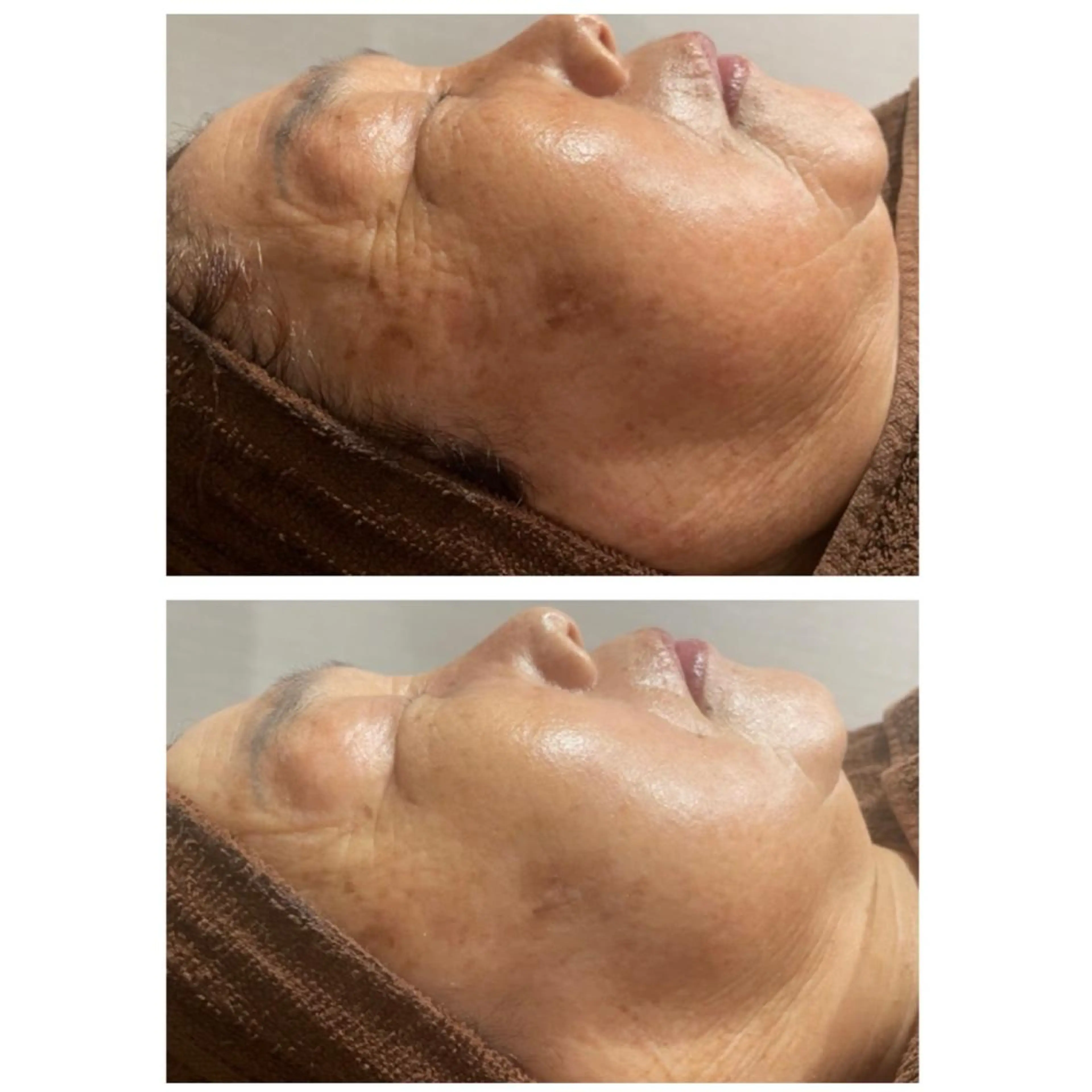 エステ 肌質改善◇結果重視 美麗-MIREI-のマツエク・マツパデザイン