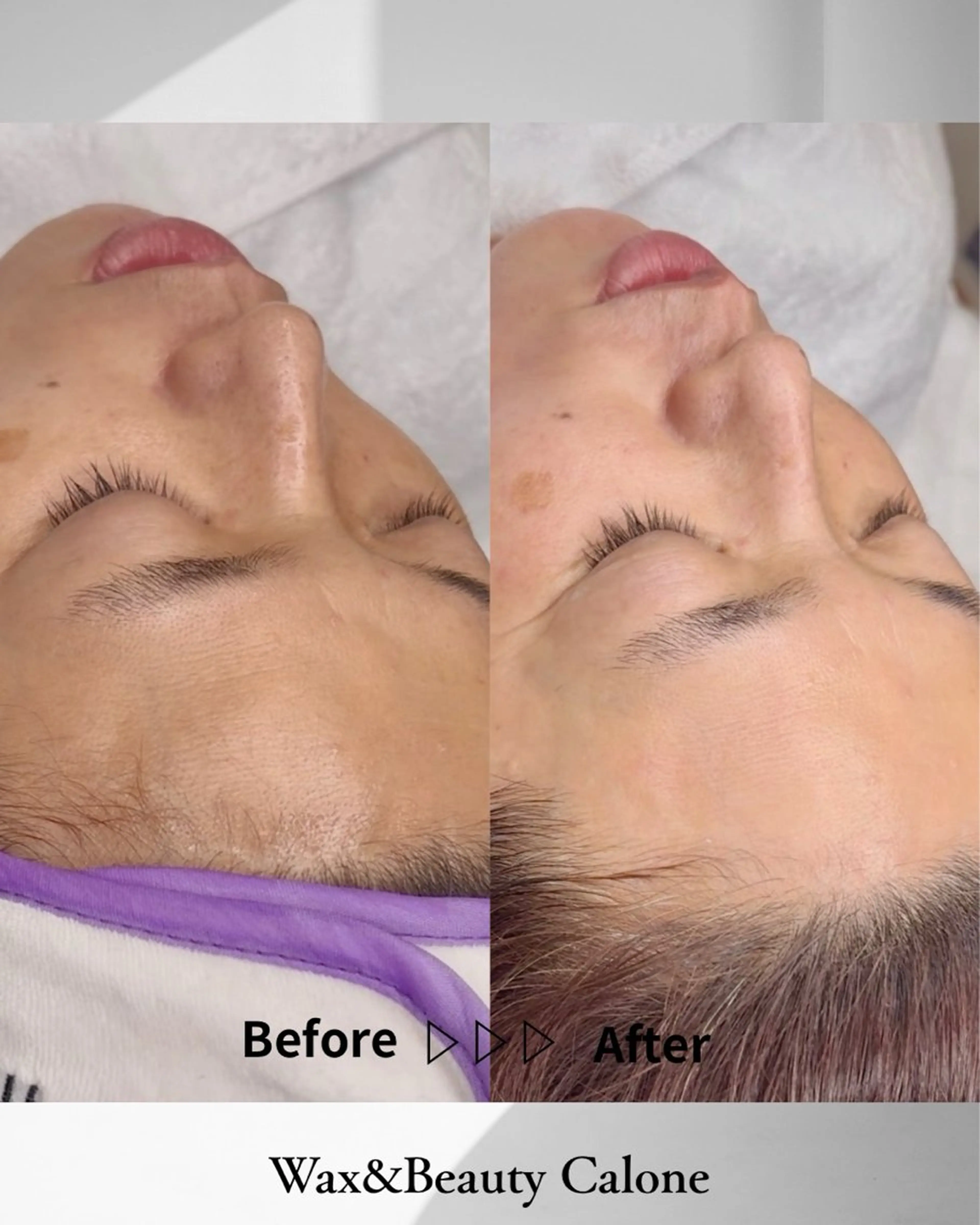 脱毛 Calone Itsukoのエステ・リラクイメージ