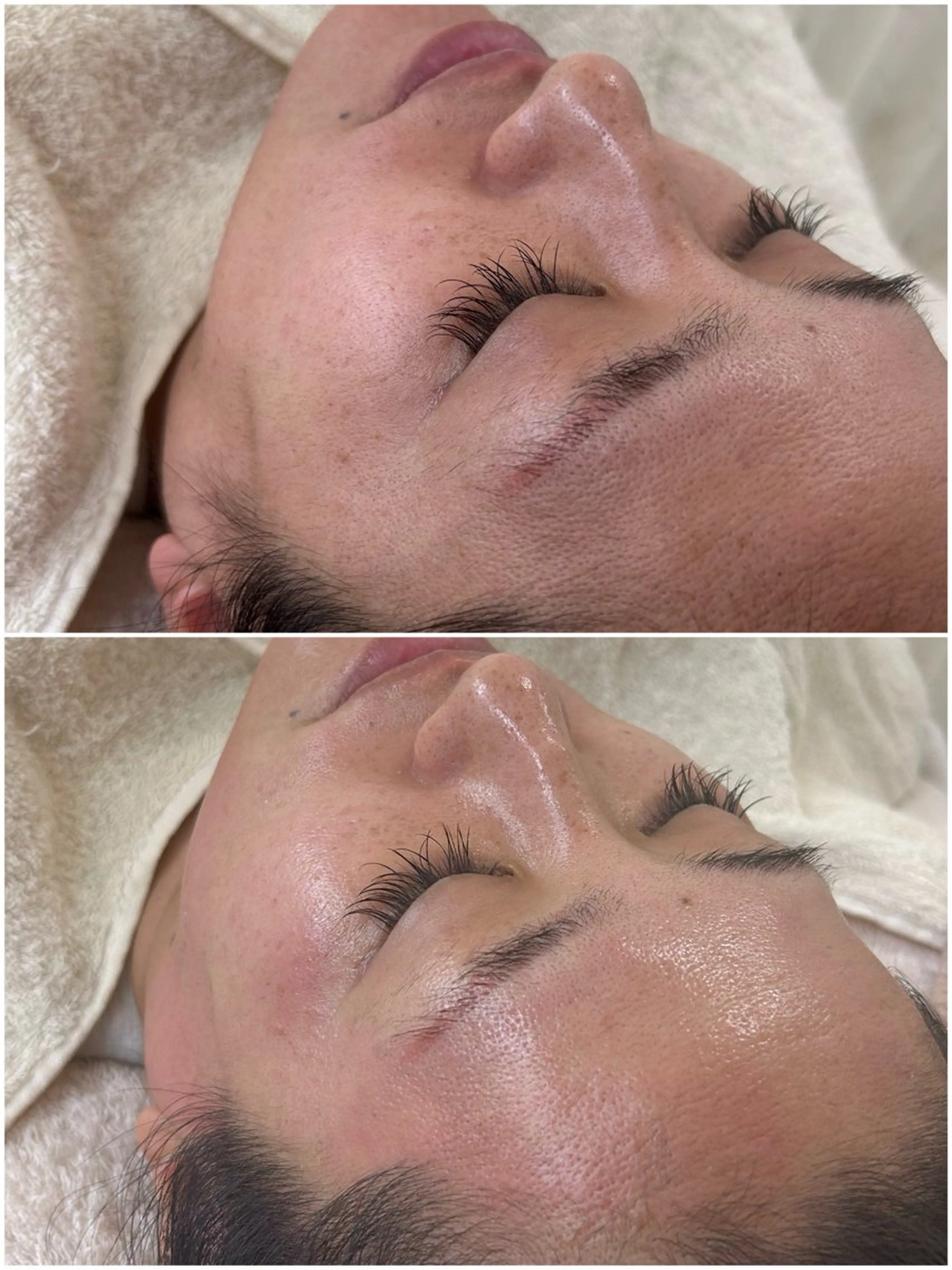 美肌育成専門サロンラクシュミー所属・毛穴肌管理サロン ラクシュミーのエステ・リラクイメージ