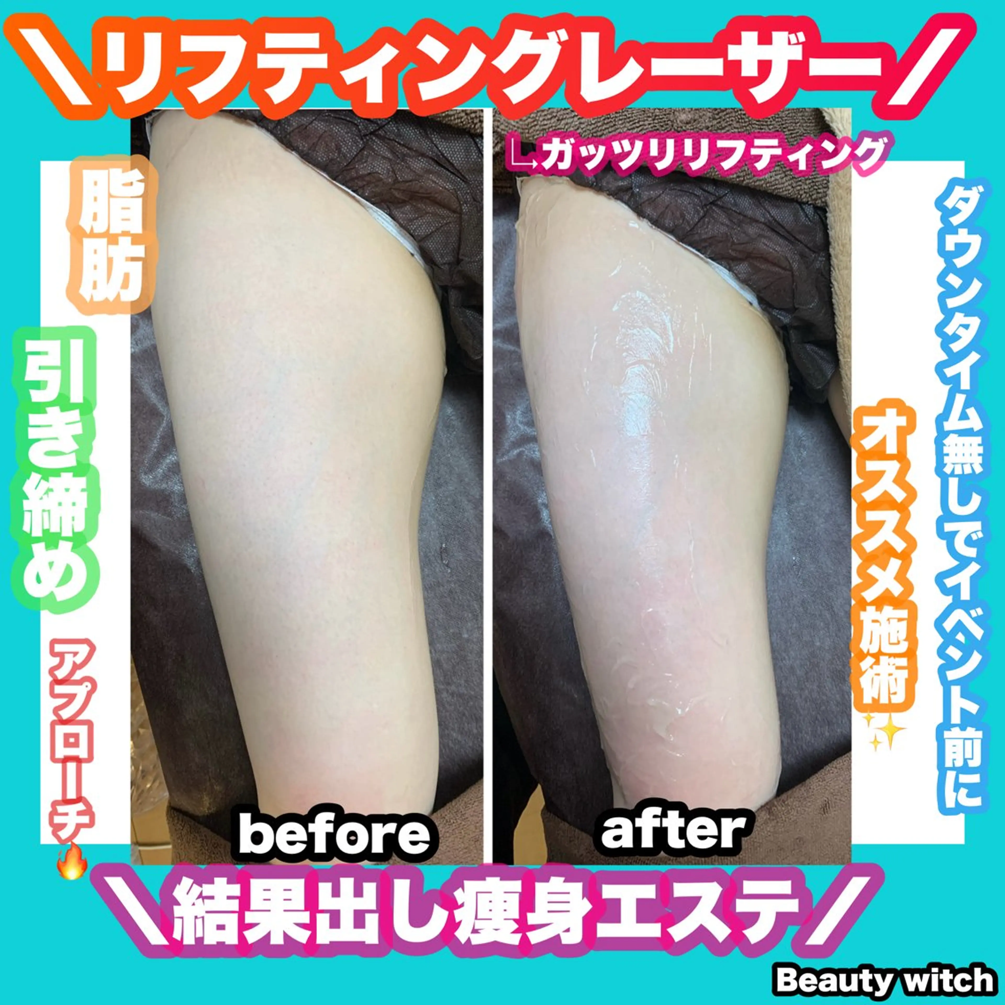 エステ 痩身/脱毛/ネイル HARUKAのエステ・リラクイメージ