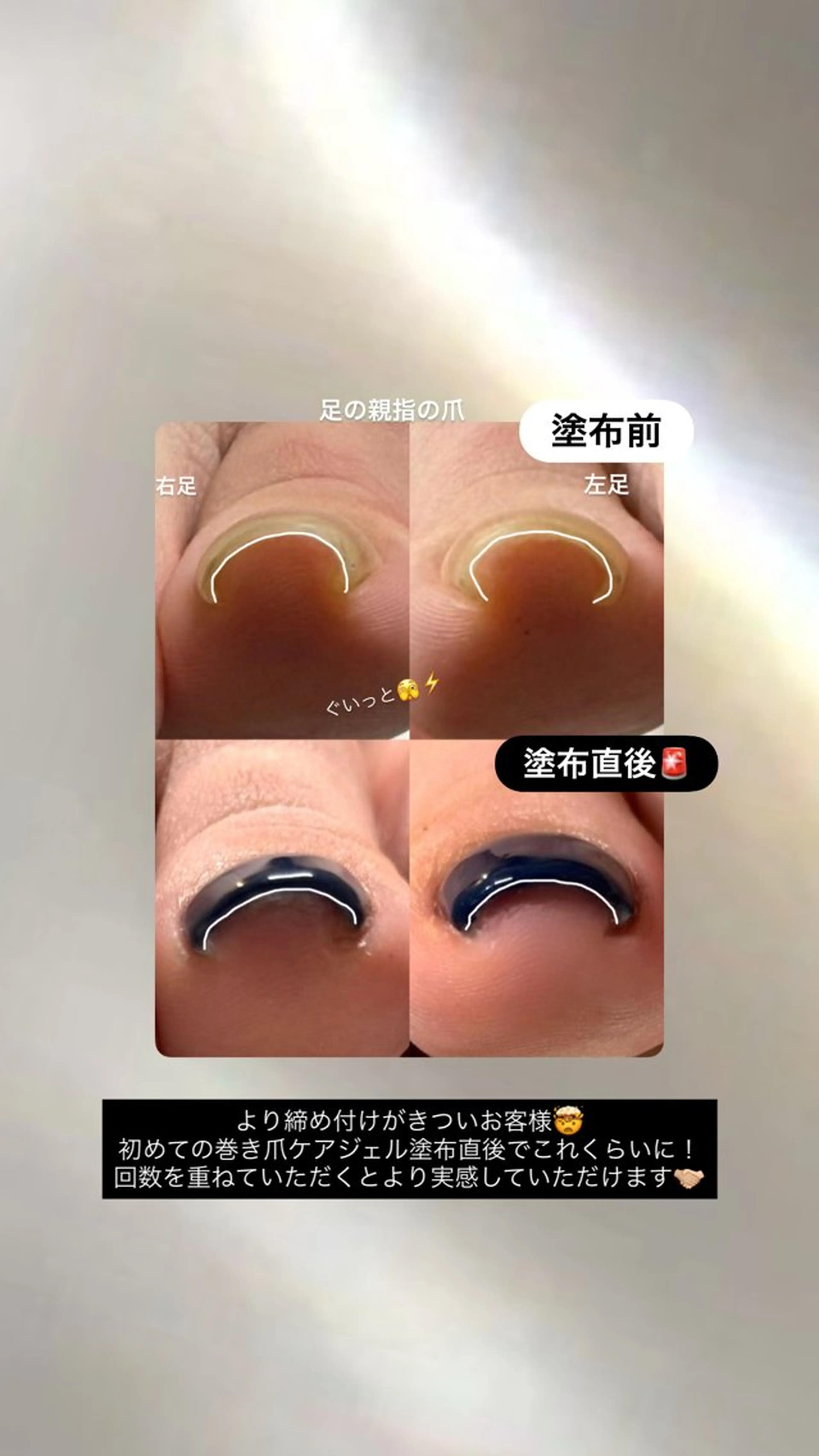 ネイル ジェルネイル フットネイル ZERO Nail Art Foot専用のネイルデザイン