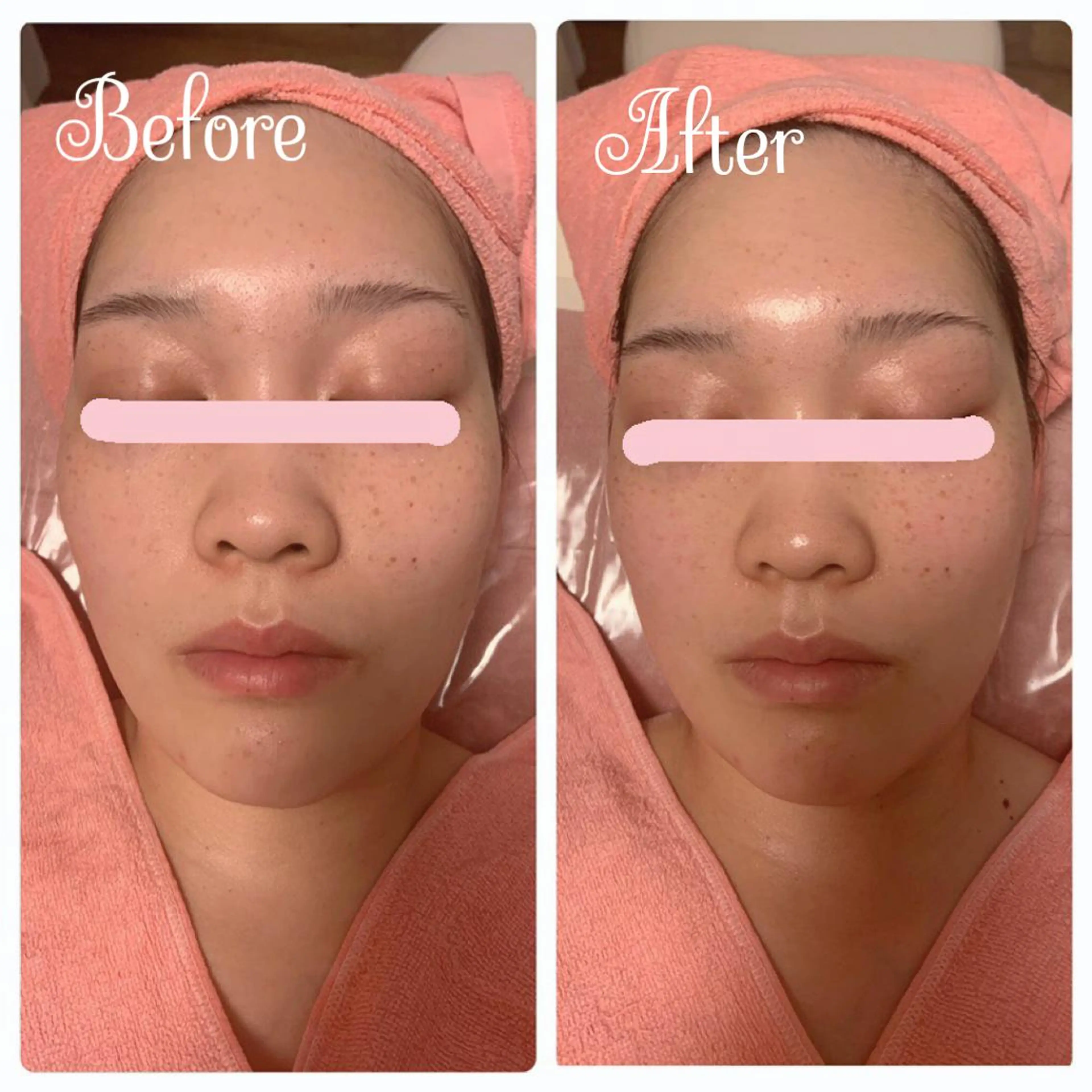 透明感の肌Lino malieのエステ・リラクイメージ