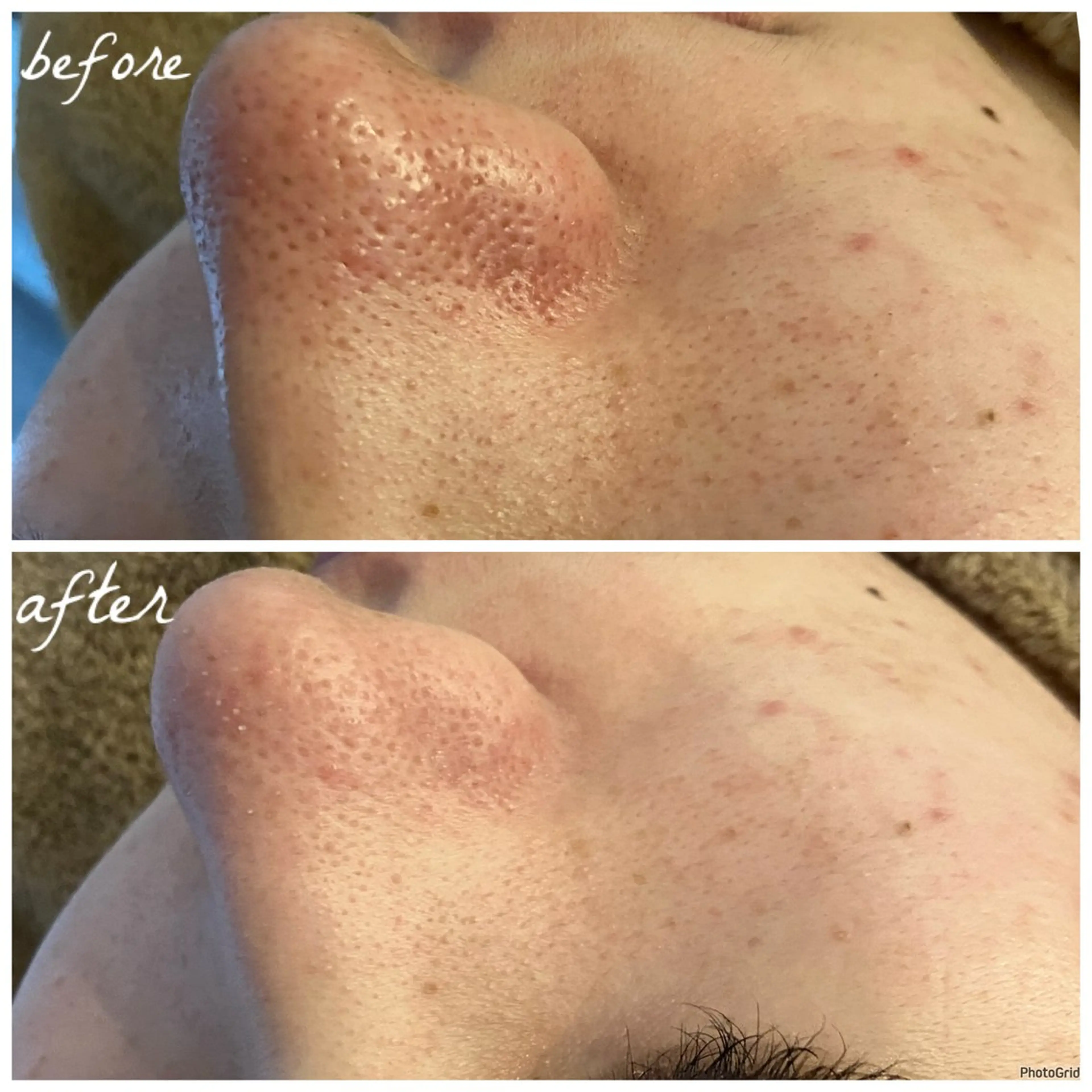 メンズ メナード岐阜茜部 杉浦のエステ・リラクイメージ