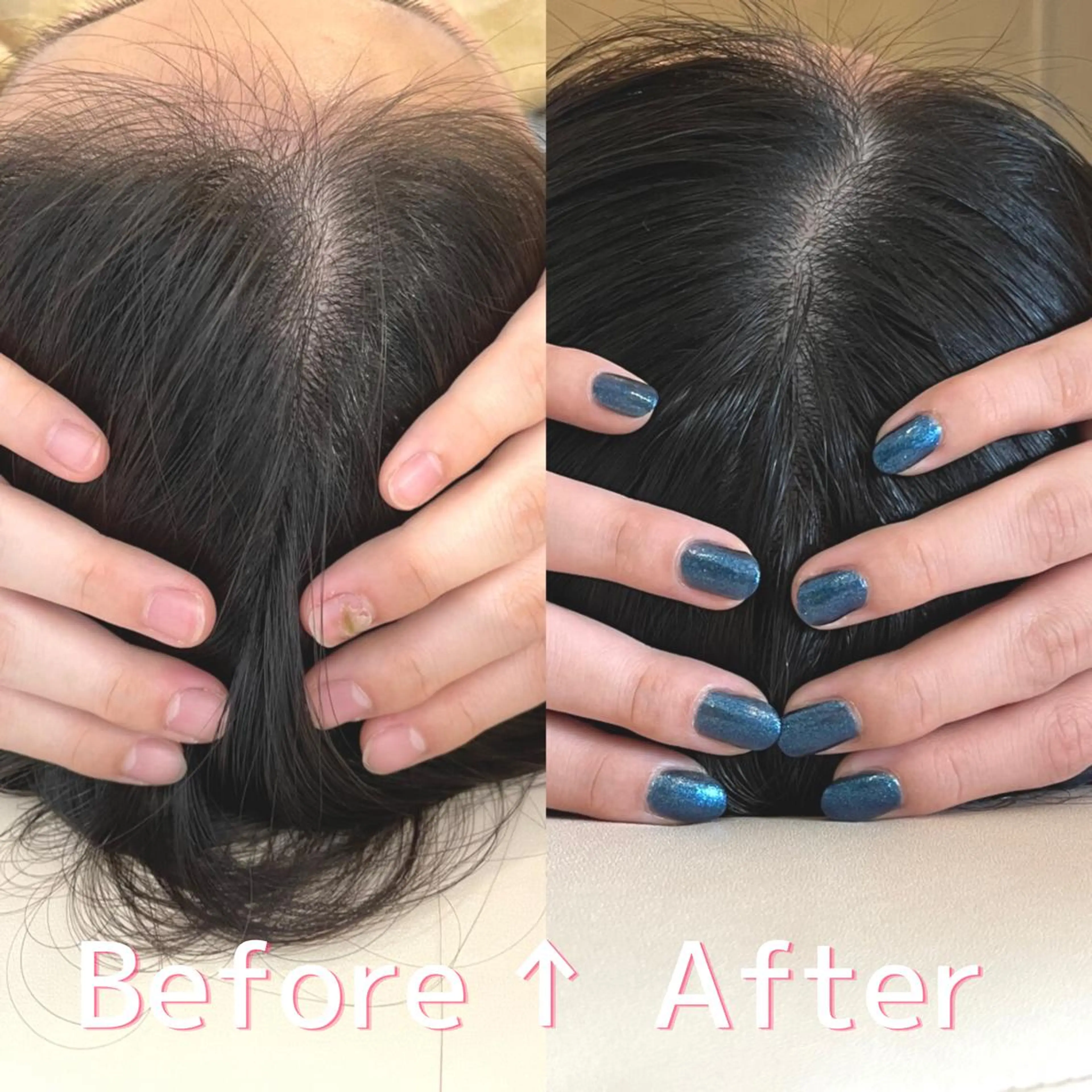 【コロナ禍応援！ミニモ限定価格】ひのえ式ヘッドリフトマッサージ90分✨💆‍♀️の写真