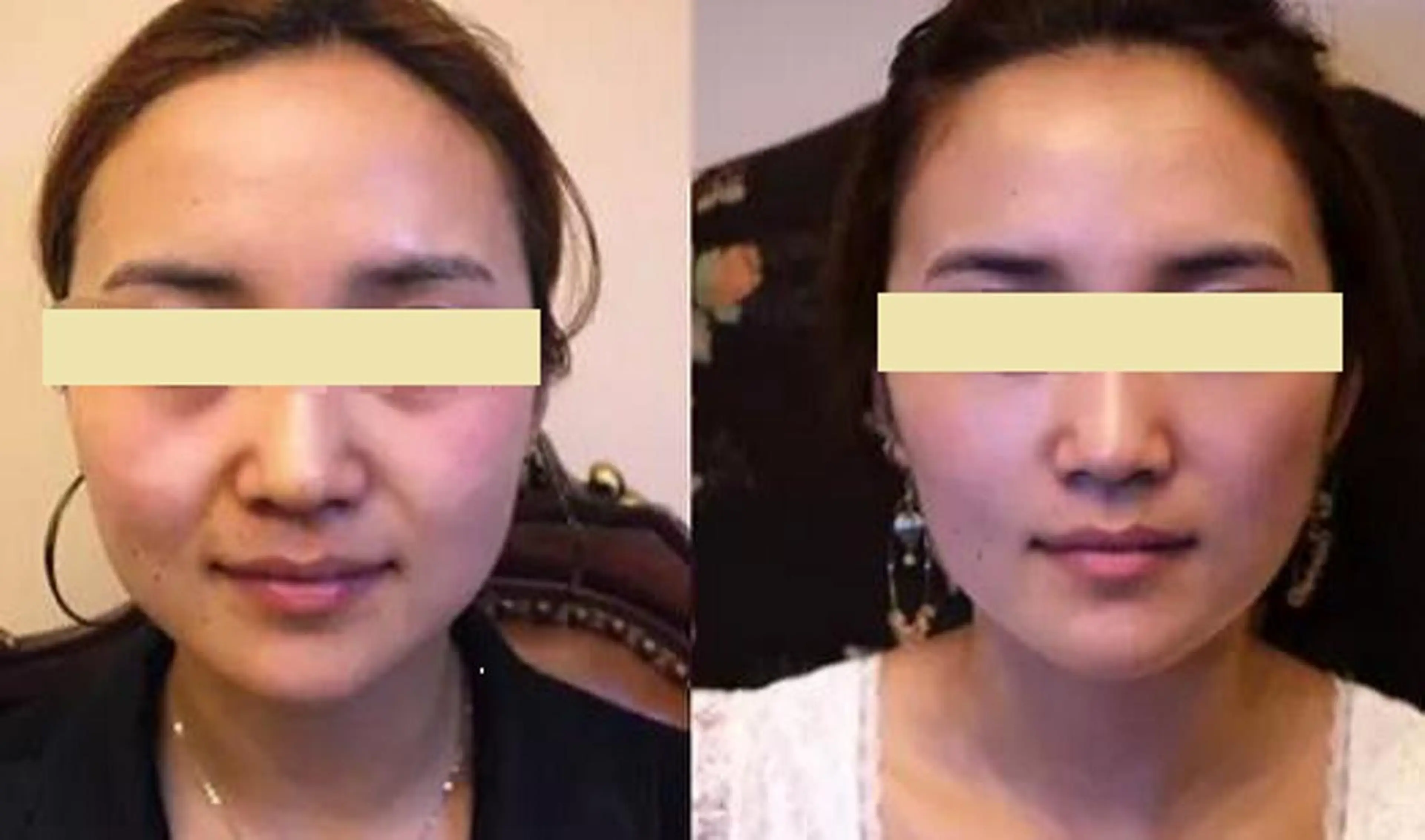 エステ 全身脱毛＆VIO脱毛 紹介率№1♪リナ♪のエステ・リラクイメージ