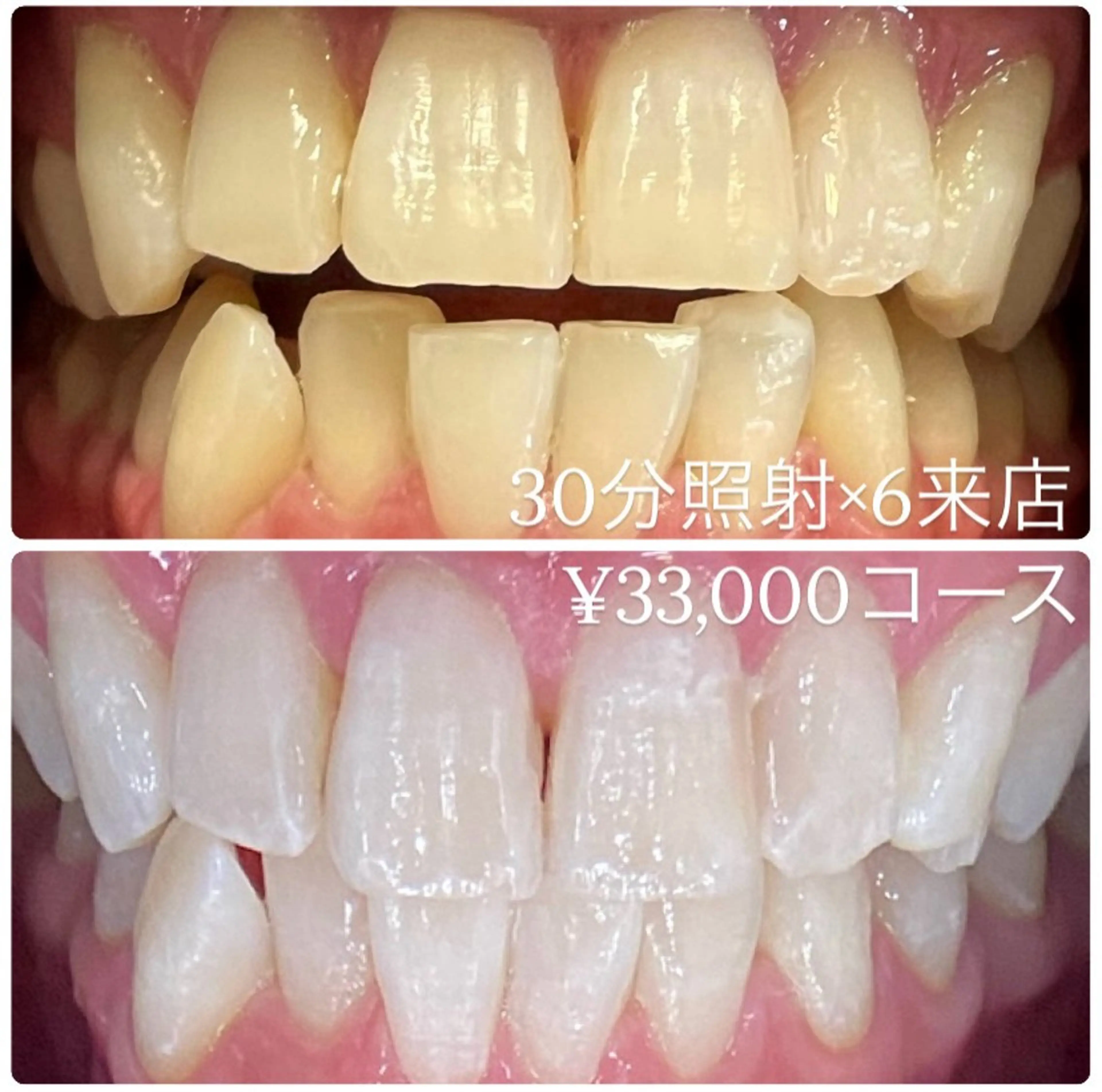 PLATINUM Beauty 横浜店所属・ホワイトニングルーム 横浜店のその他イメージ