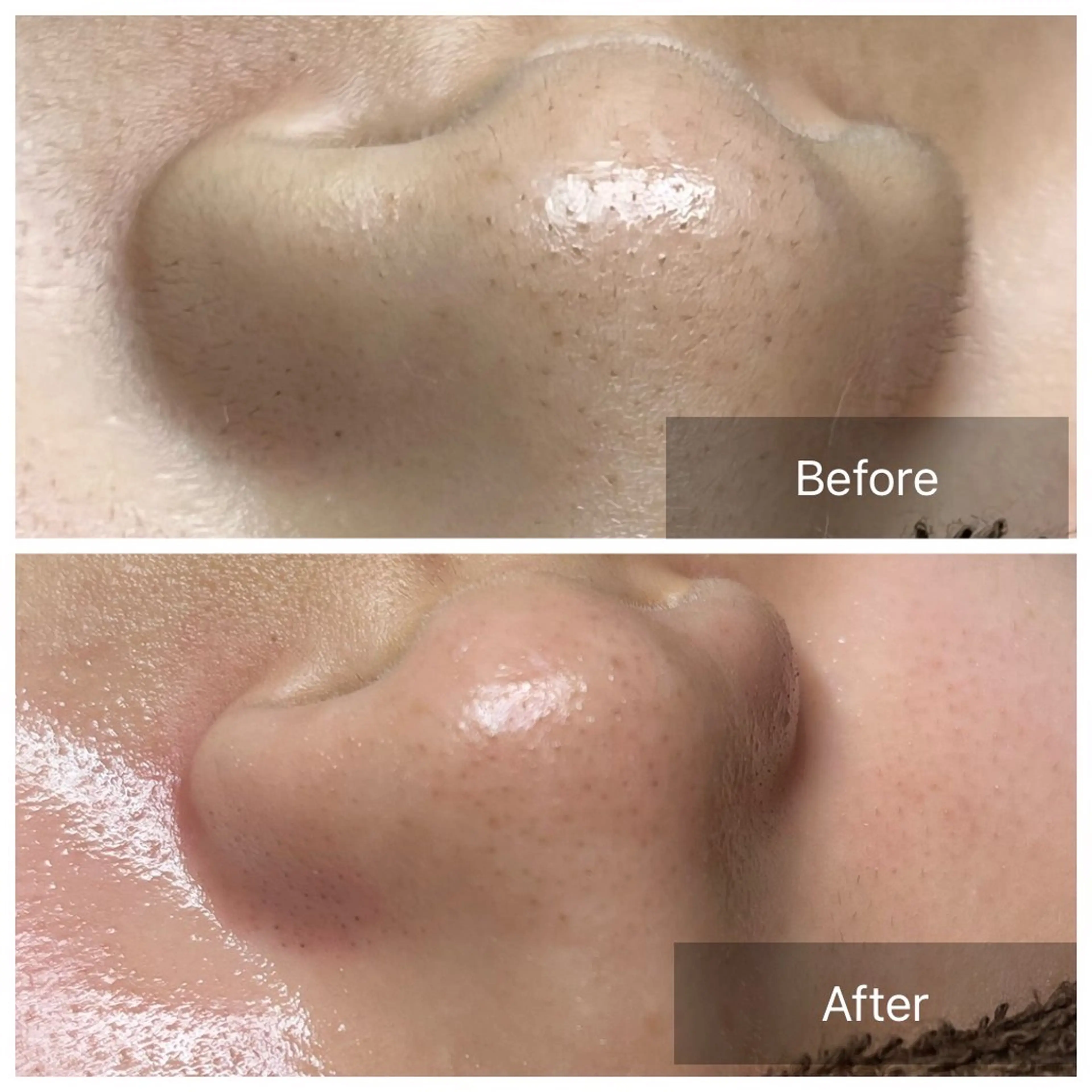 salon improve所属・Salon Improveのネイルデザイン