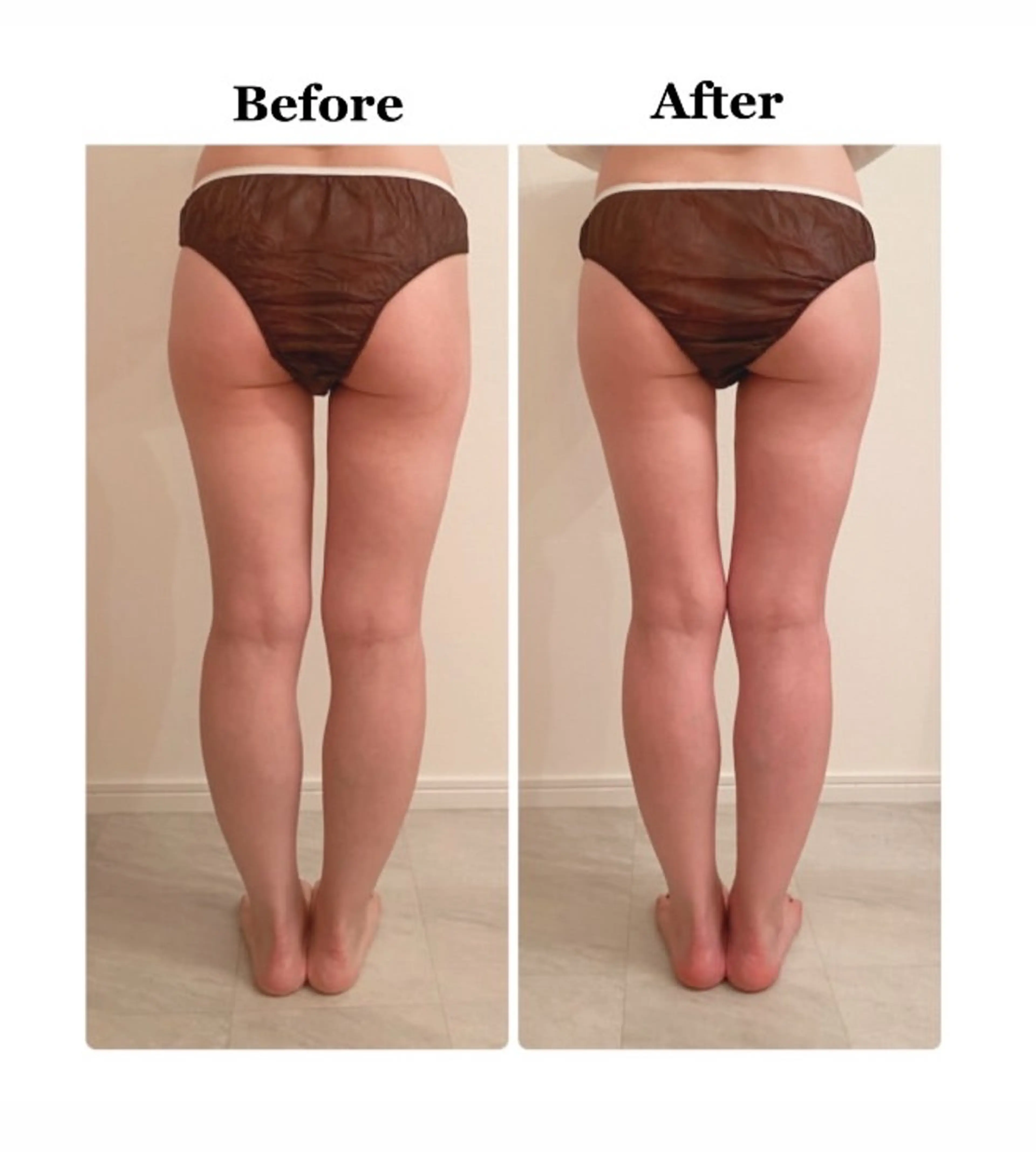 日本一ムクミがとれる salon Flotのエステ・リラクイメージ